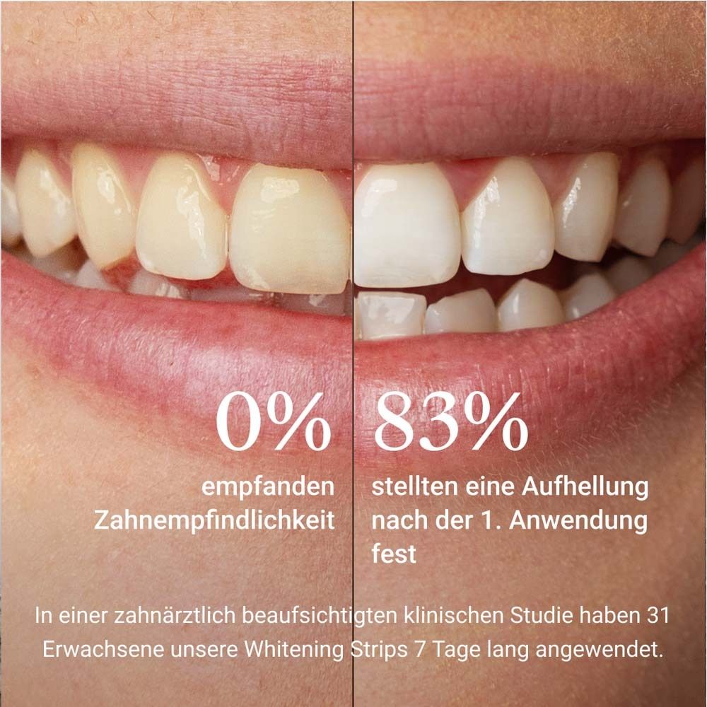 Dents avant/après. 0% sensibilité, 83% éclaircissement après 1ère application.