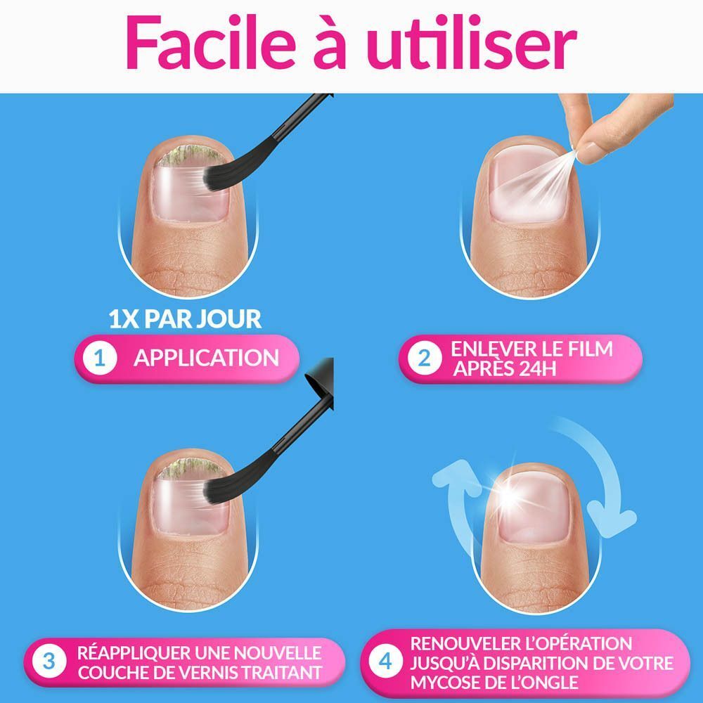 Schéma d'application du traitement pour mycose des ongles Excilor® sans limer.