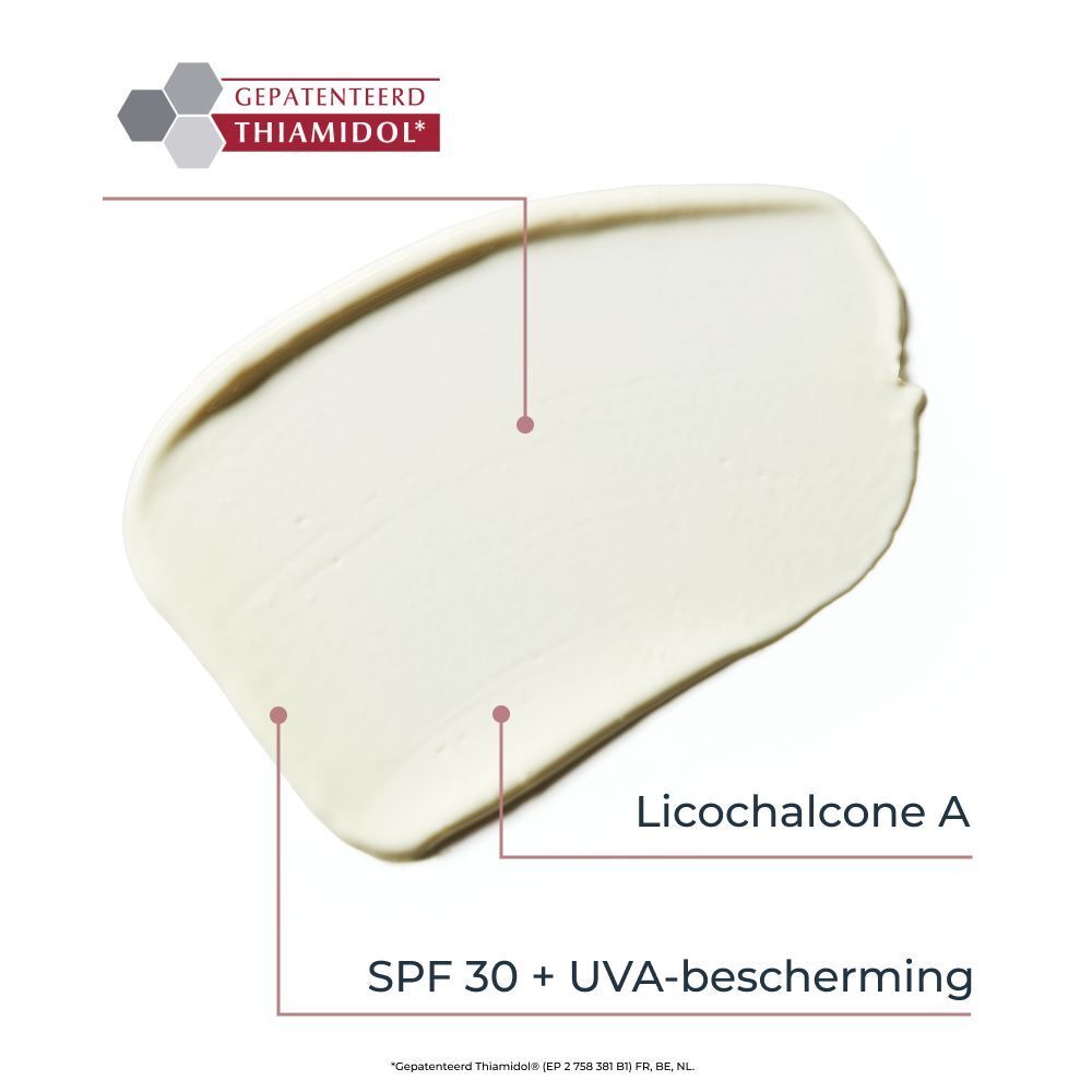 Voor-en-na-afbeeldingen van huidpigmentatie behandeld met Eucerin Anti-Pigment.
