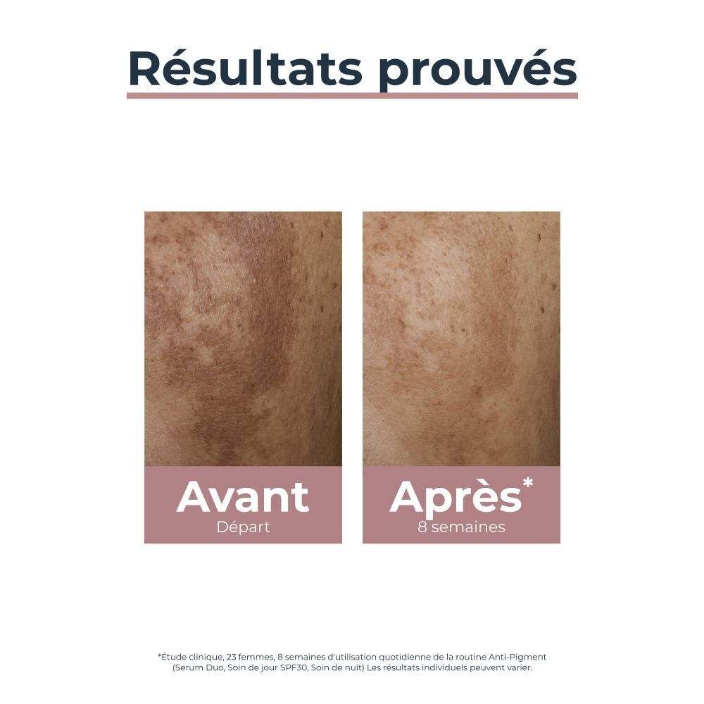 Routine Eucerin Anti-Pigment : Soin Contour des Yeux, Sérum Duo, Soin de Jour SPF 30.