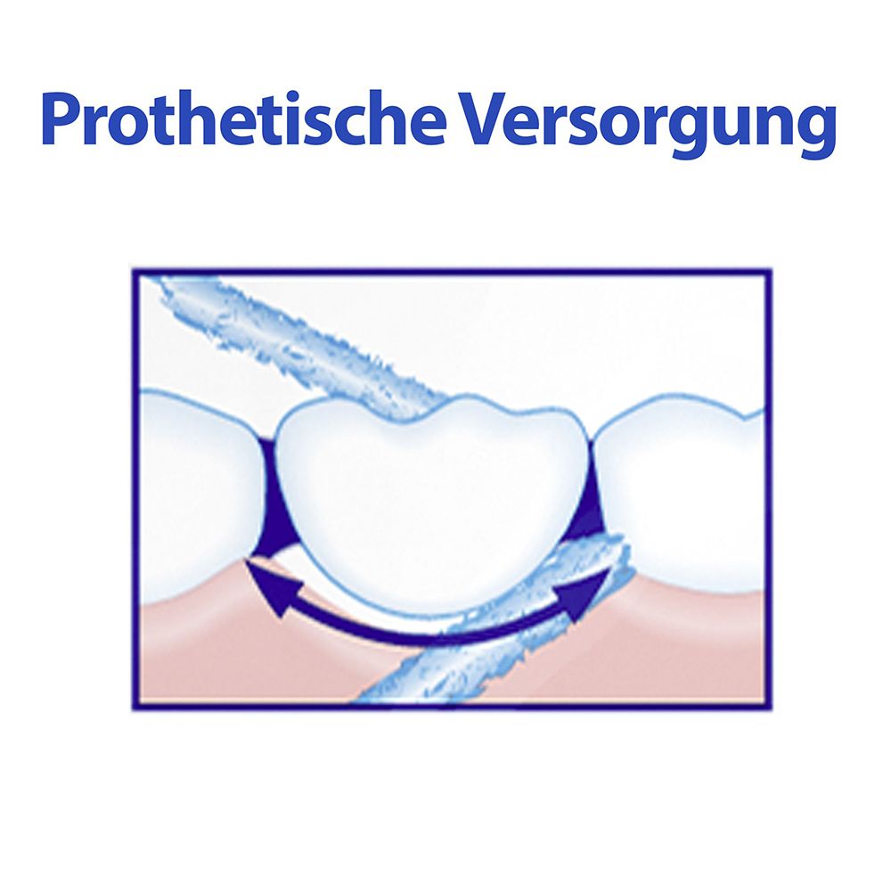 Illustratie: reiniging onder prothesen. Pijlen tonen de beweging van de flossdraad.