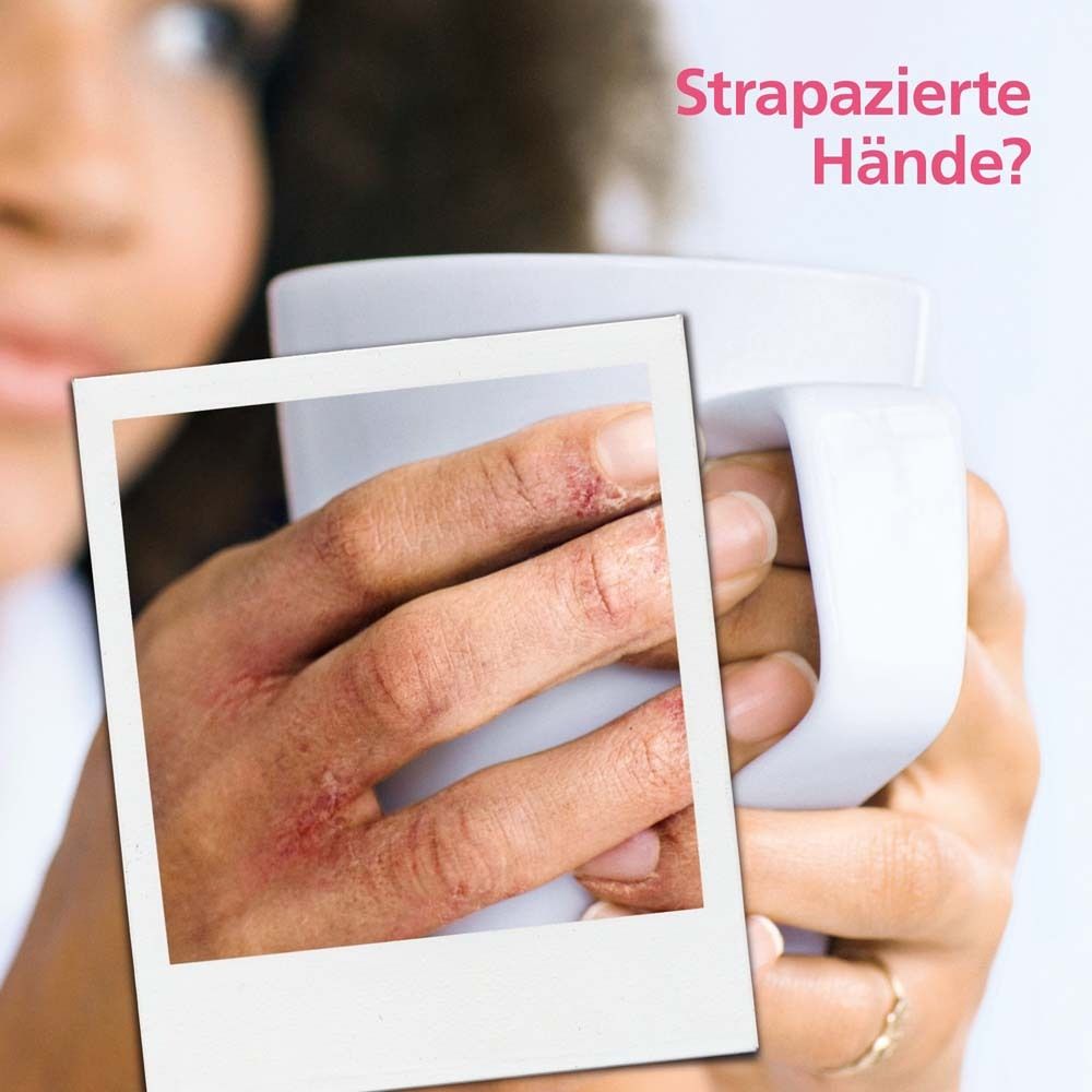 Photo de mains abîmées dans un cadre blanc. Texte : Mains abîmées ?