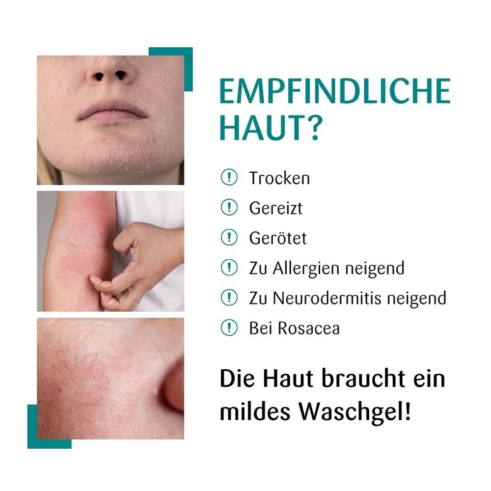 Gevoelige huid: Droog, geïrriteerd, rood, gevoelig voor allergieën, eczeem of rosacea.