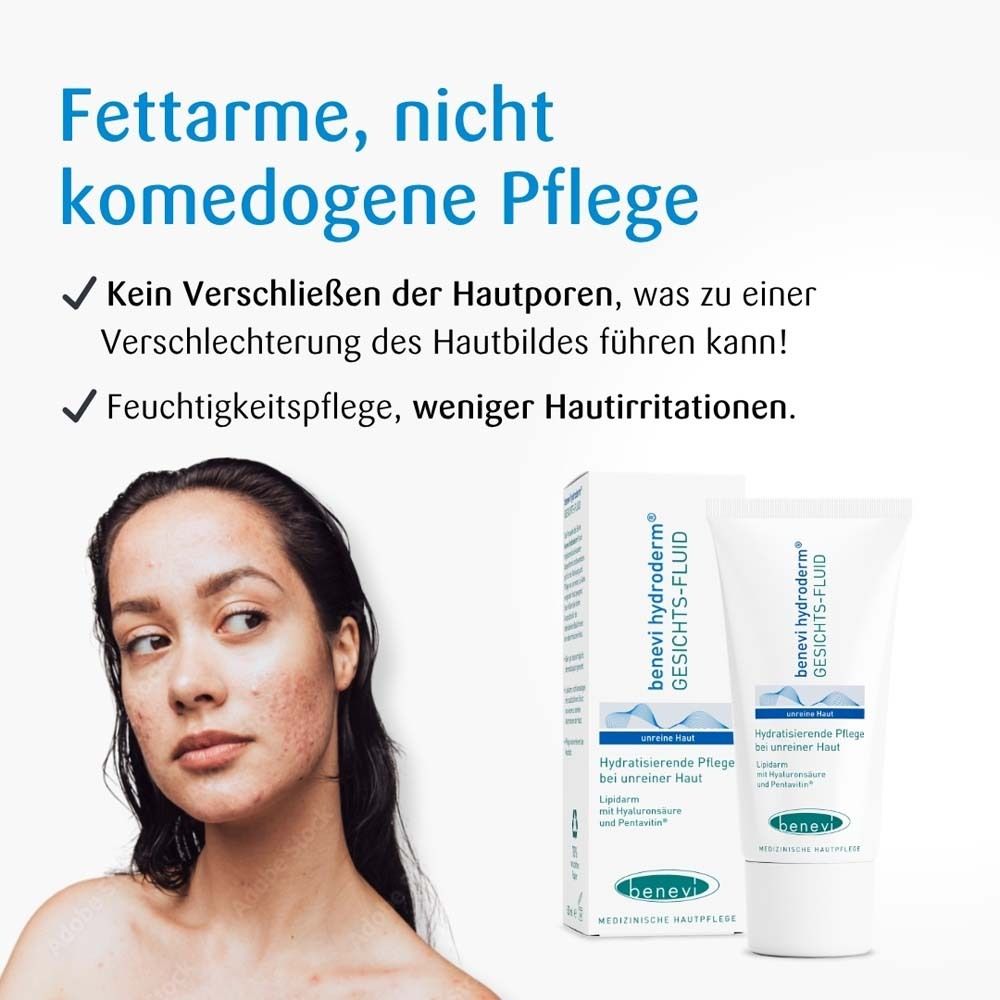 Femme avec imperfections cutanées à côté du texte. Texte : Soin non comédogène et à faible teneur en matières grasses. Hydratation.