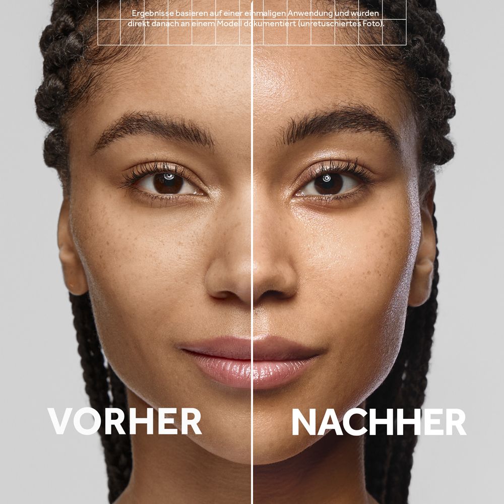 Comparaison avant-après du visage d'une femme montrant l'effet d'un produit de soin.
