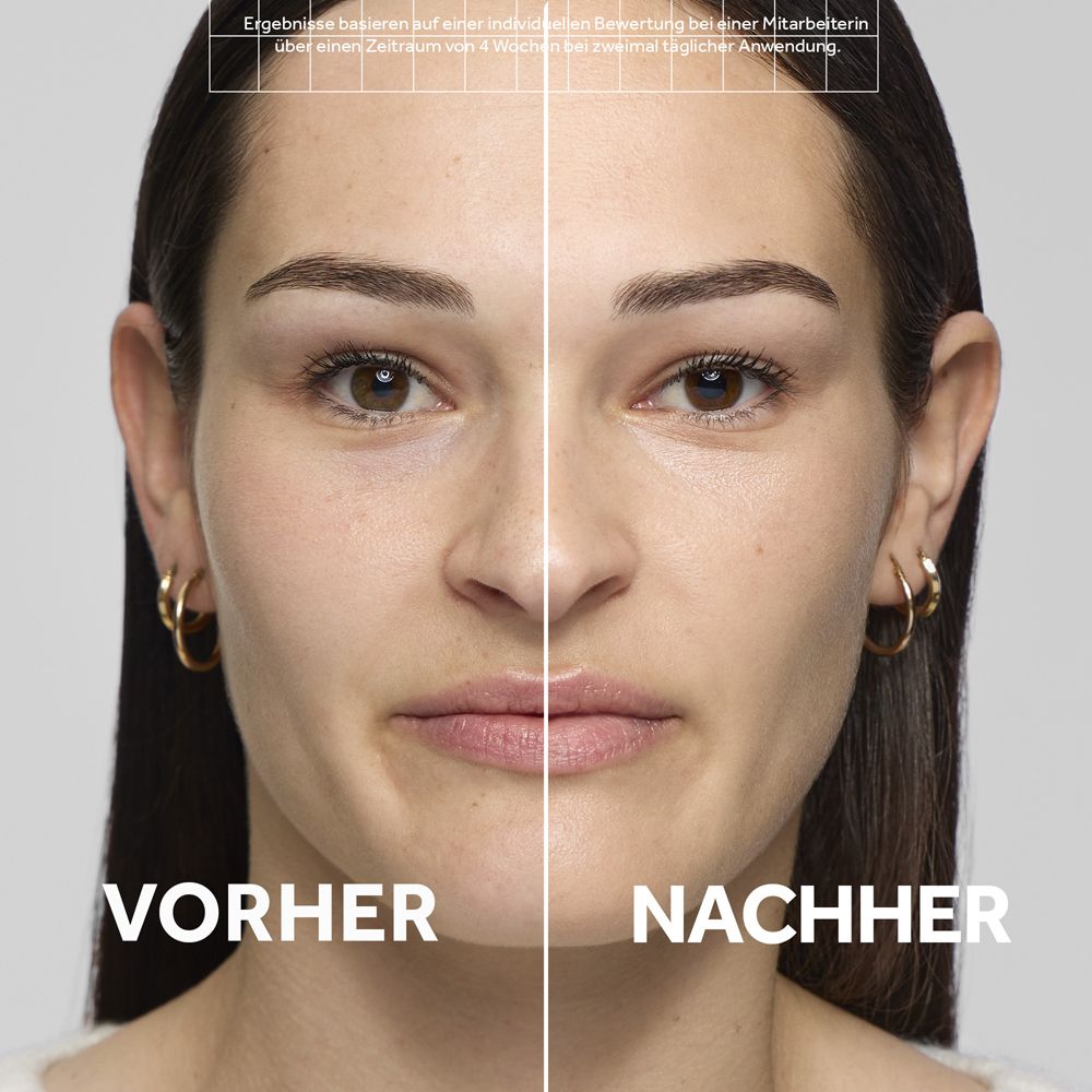Comparaison avant-après d'une femme avec une peau améliorée.
