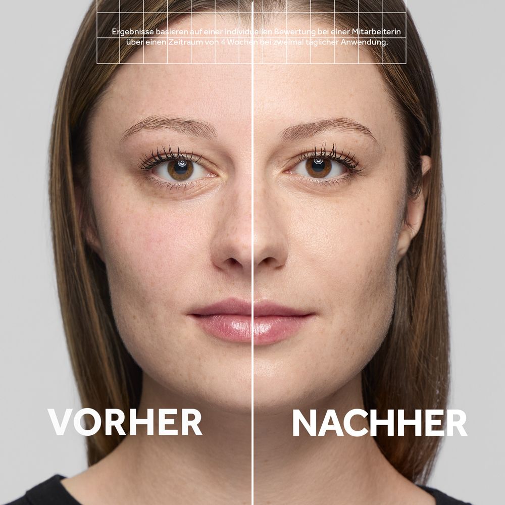 Comparaison avant-après d'un visage ayant reçu un traitement cutané.