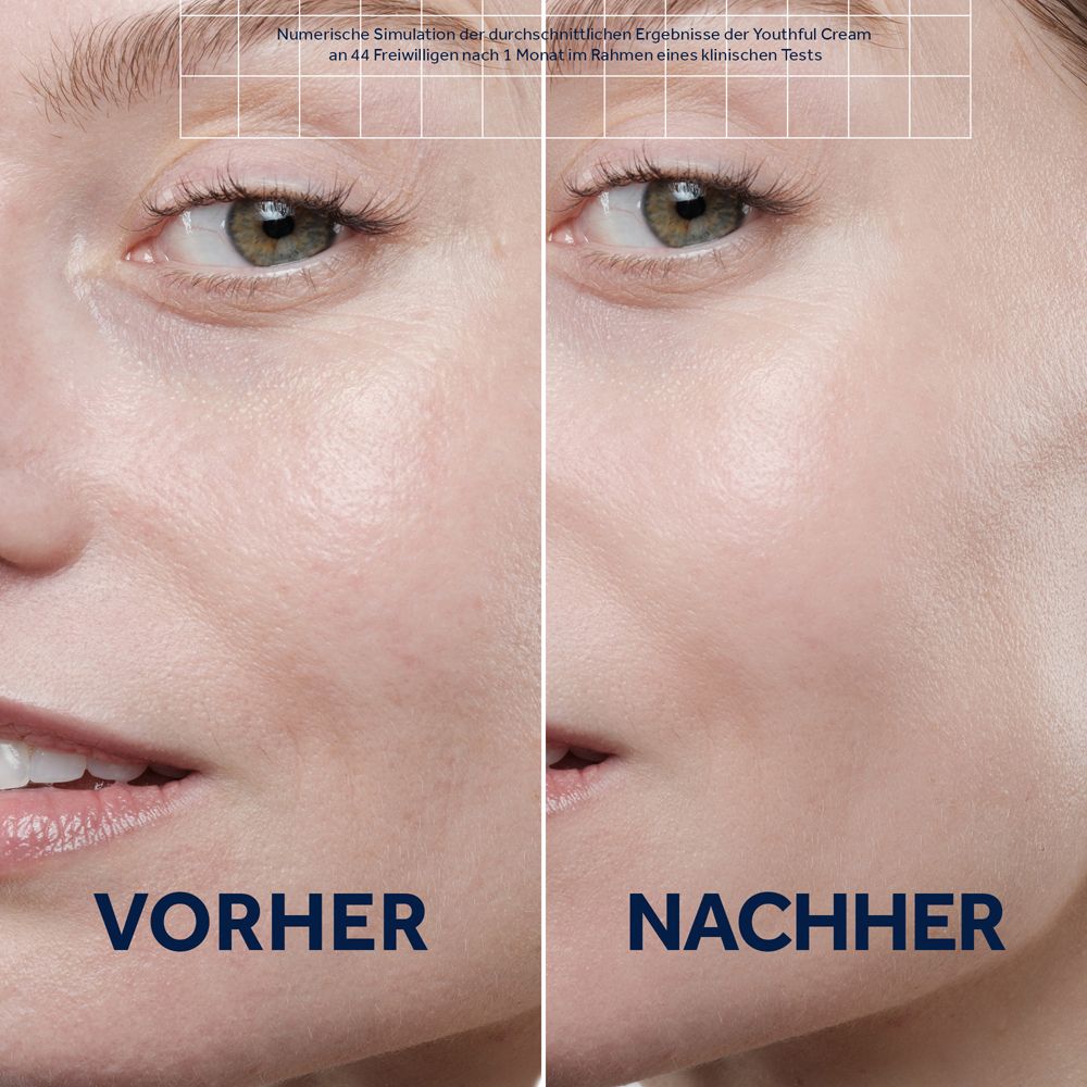 Voor-na vergelijking. Gezichtshelften. Links: Voor. Rechts: Na. Tekst: Youthful Cream.