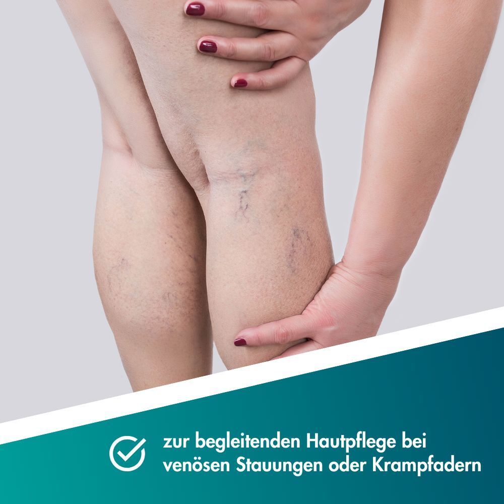 Jambes avec varices visibles, une main tient le genou.