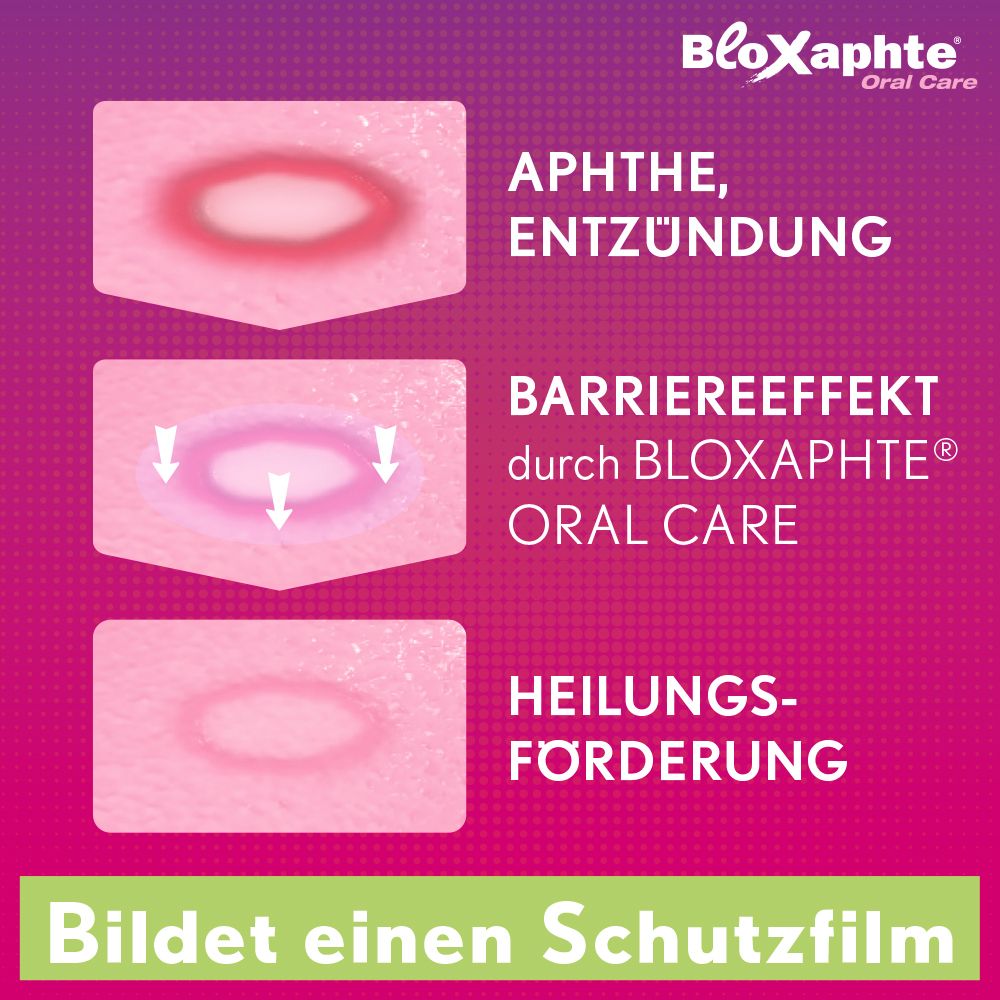 Grafische weergave van het effect. Tekst: Barrière-effect, bevordert genezing. BloXaphte Oral Care.
