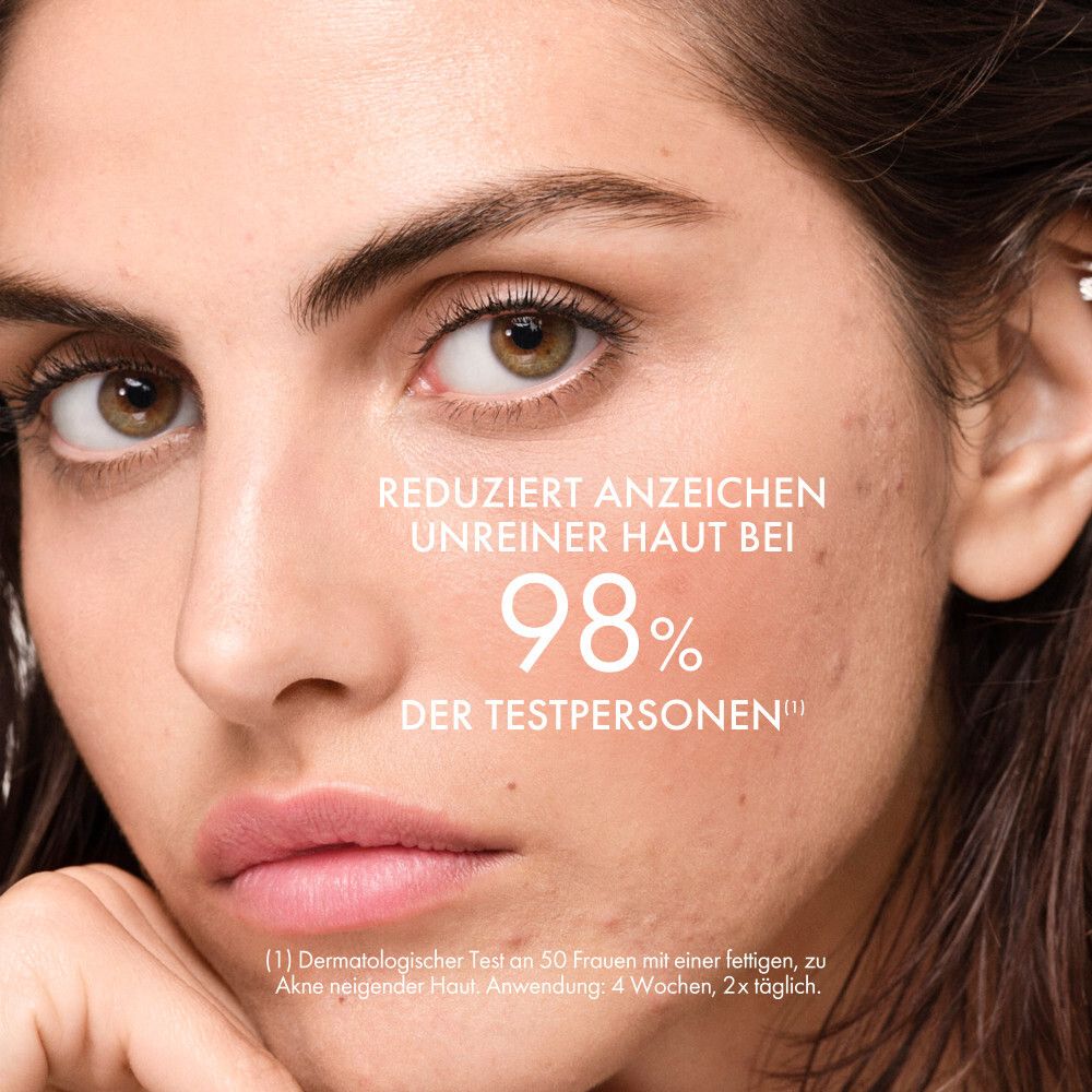 Gros plan d'une femme à la peau impure, montrant une réduction de 98%.