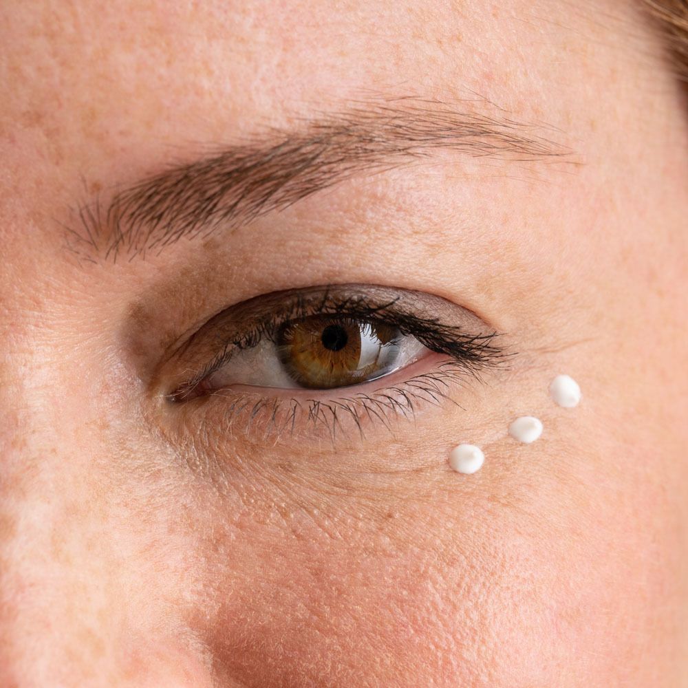 Oog met crèmestippen eronder. Bruine oogkleur.