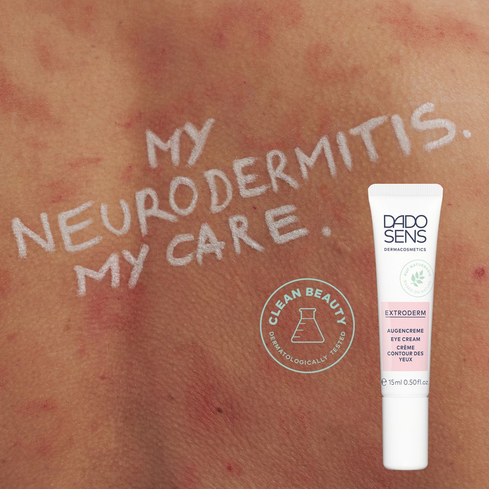 Huid met roodheid en tekst: 'MY NEURODERMITIS. MY CARE.' ernaast tube.