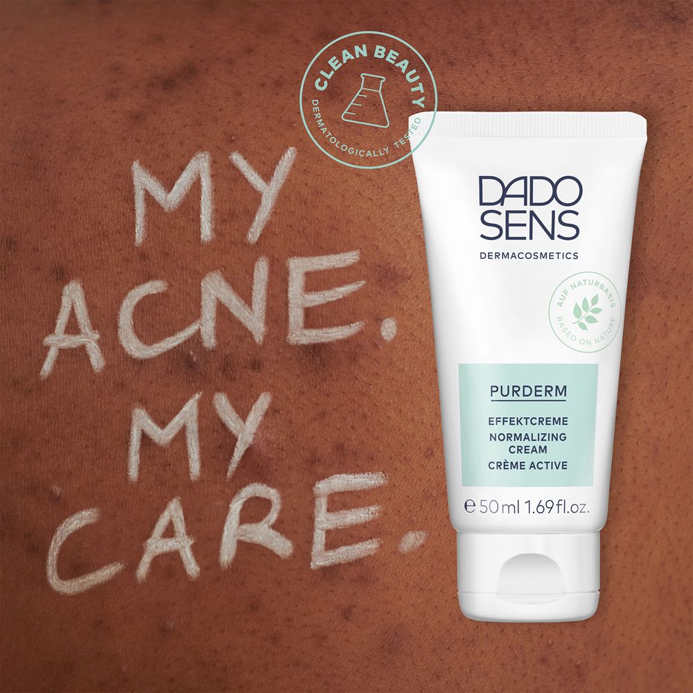 Tube met product en tekst op huid. Tekst: My Acne. My Care. Logo en productnaam zichtbaar.