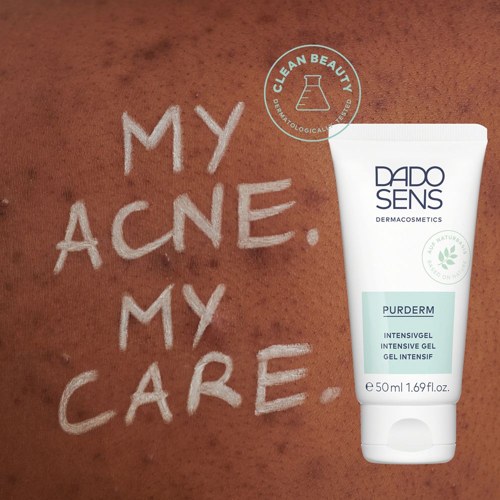Peau avec acné, à côté d'un tube de DADO SENS PURDERM Intensivgel. Texte: My Acne. My Care.
