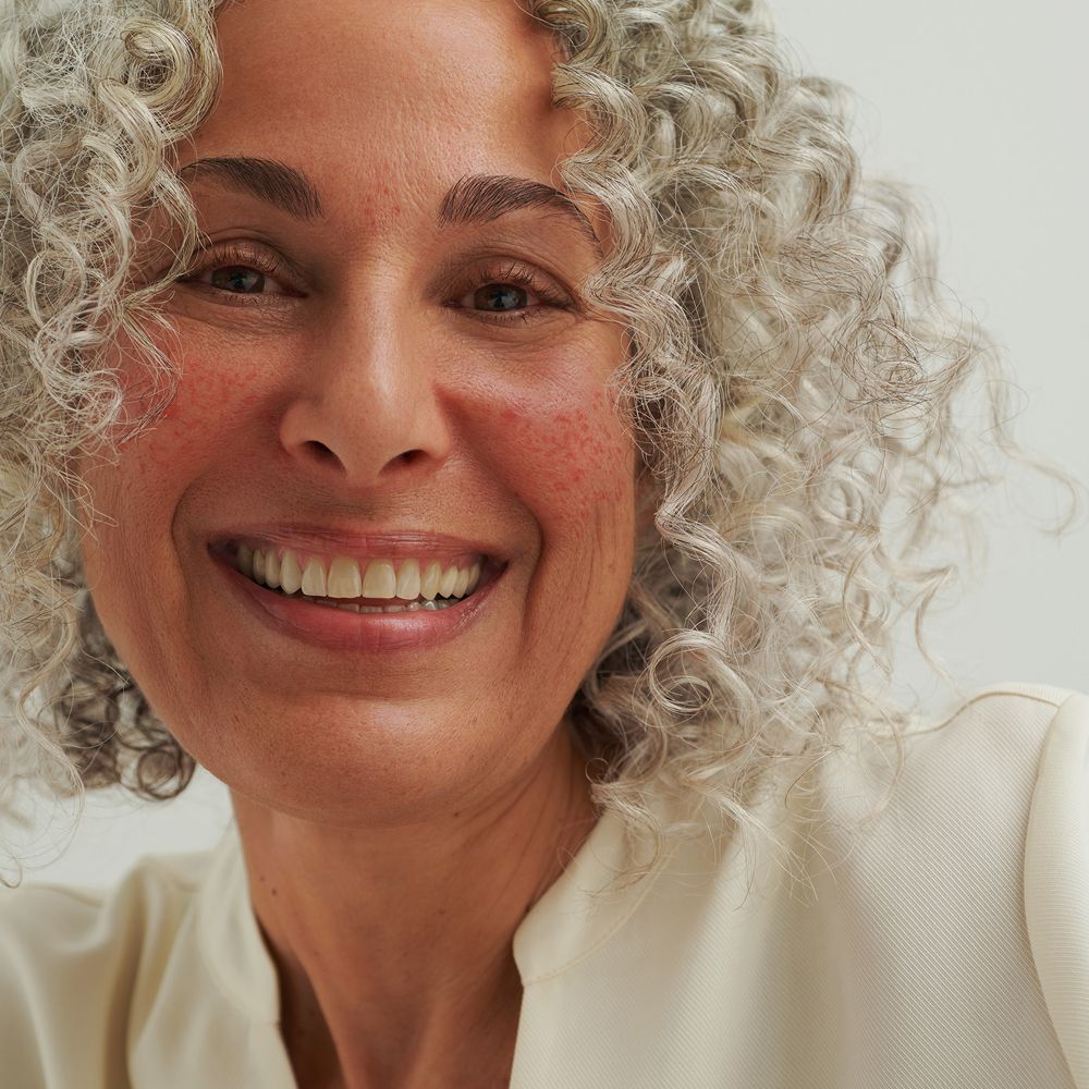 Femme souriante. Cheveux gris, peau rougie. Haut crème. Gros plan.