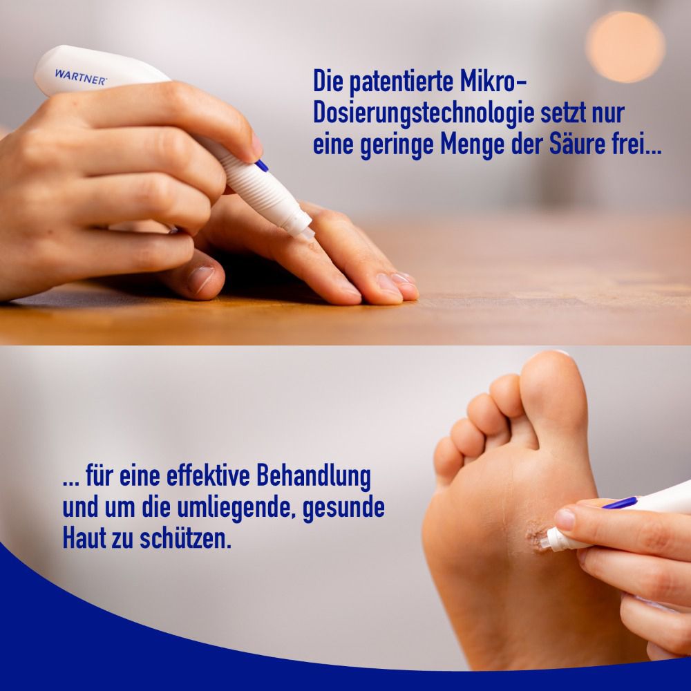 Mains et pieds avec stylo. Texte : La technologie de micro-dosage brevetée ne libère qu'une petite quantité d'acide.