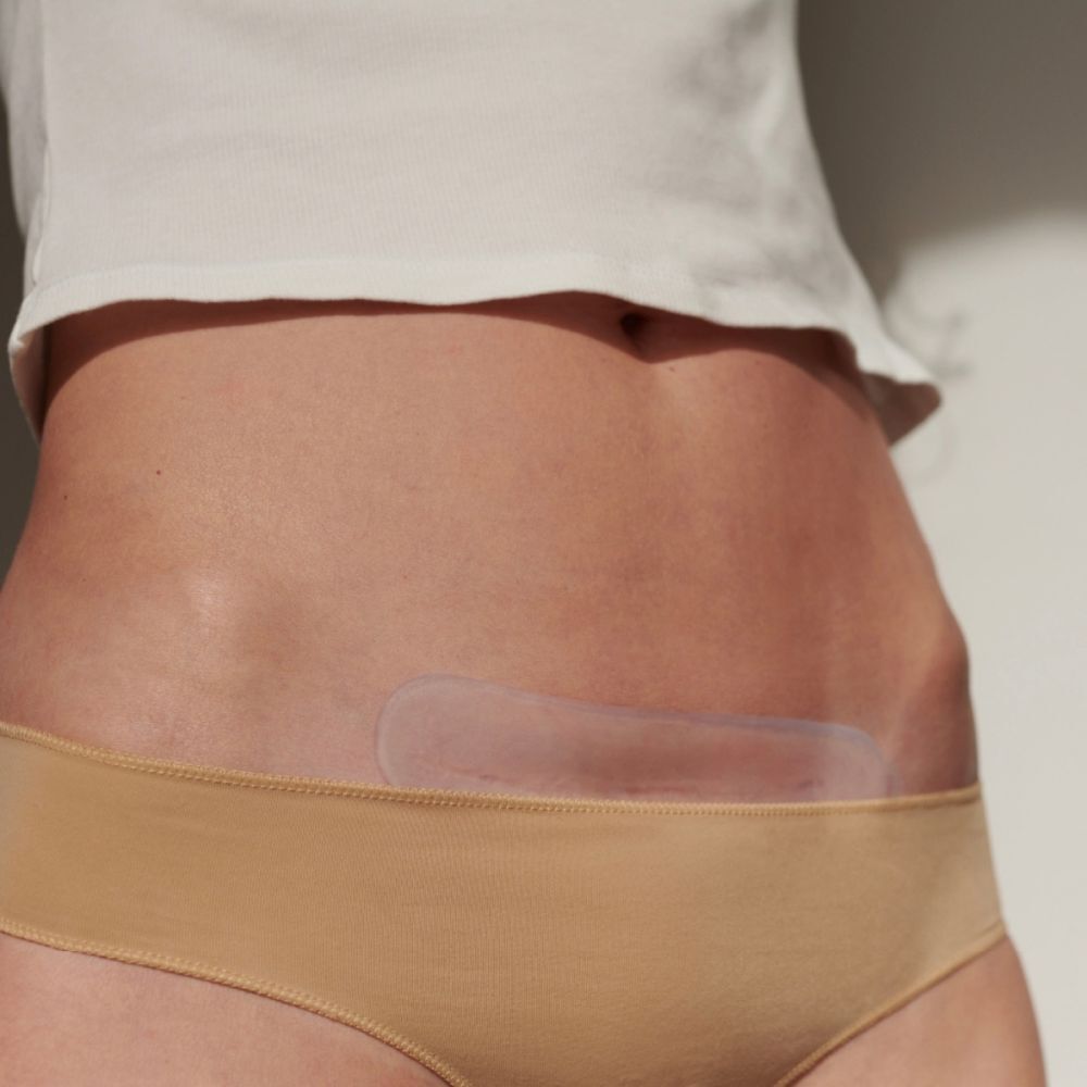 Persoon met een transparante littekenpad op de buik. Huidkleurig ondergoed.
