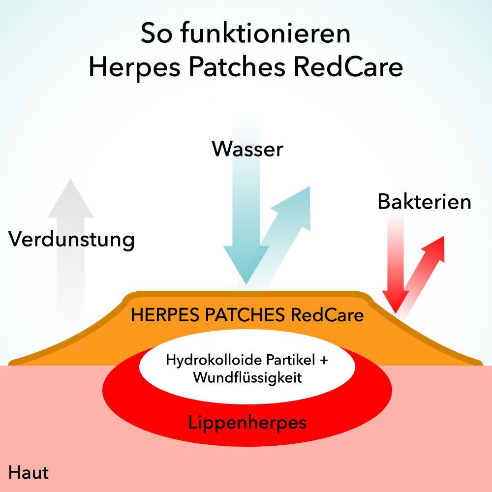 Redcare Herpes Patches