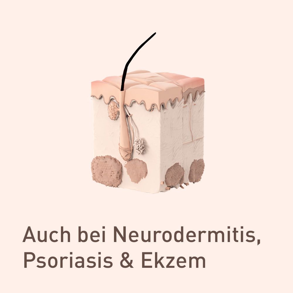 Model van een stuk huid met haar. Tekst: Ook bij atopische dermatitis, psoriasis & eczeem.