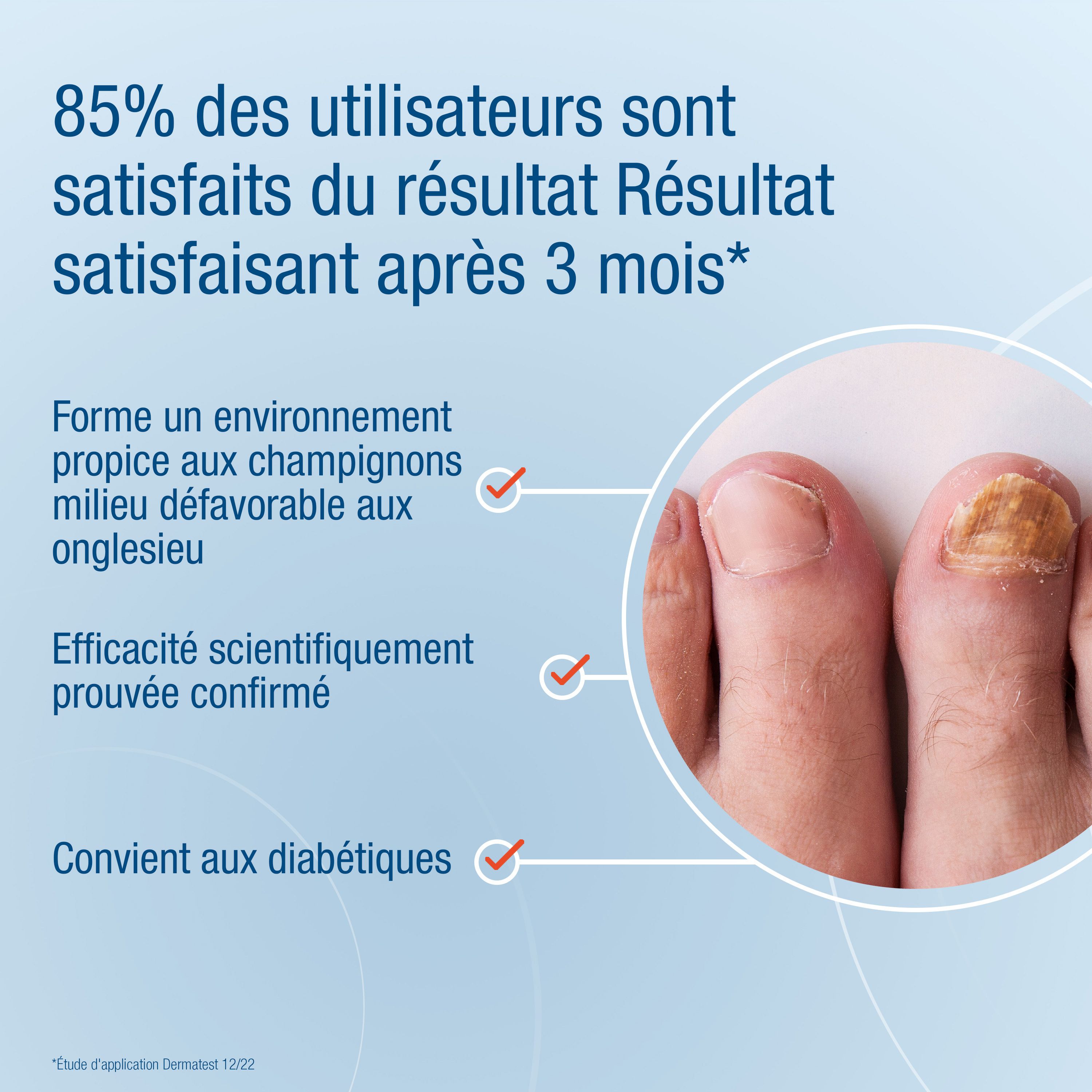 Infographie : Résultats après 3 mois. 85% des utilisateurs satisfaits. Orteils avec mycose.