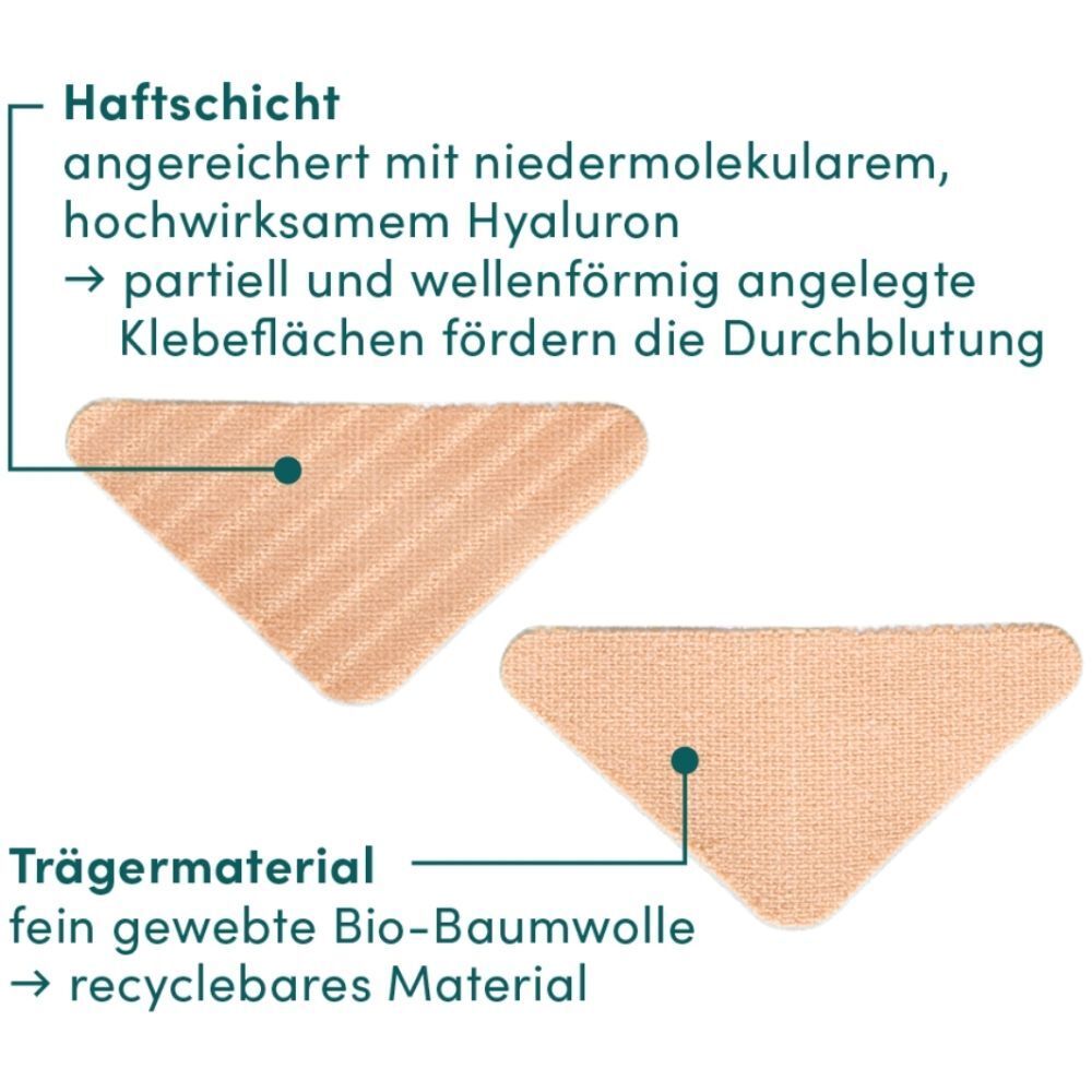 Twee patches met labels. Kleeflaag en dragermateriaal.
