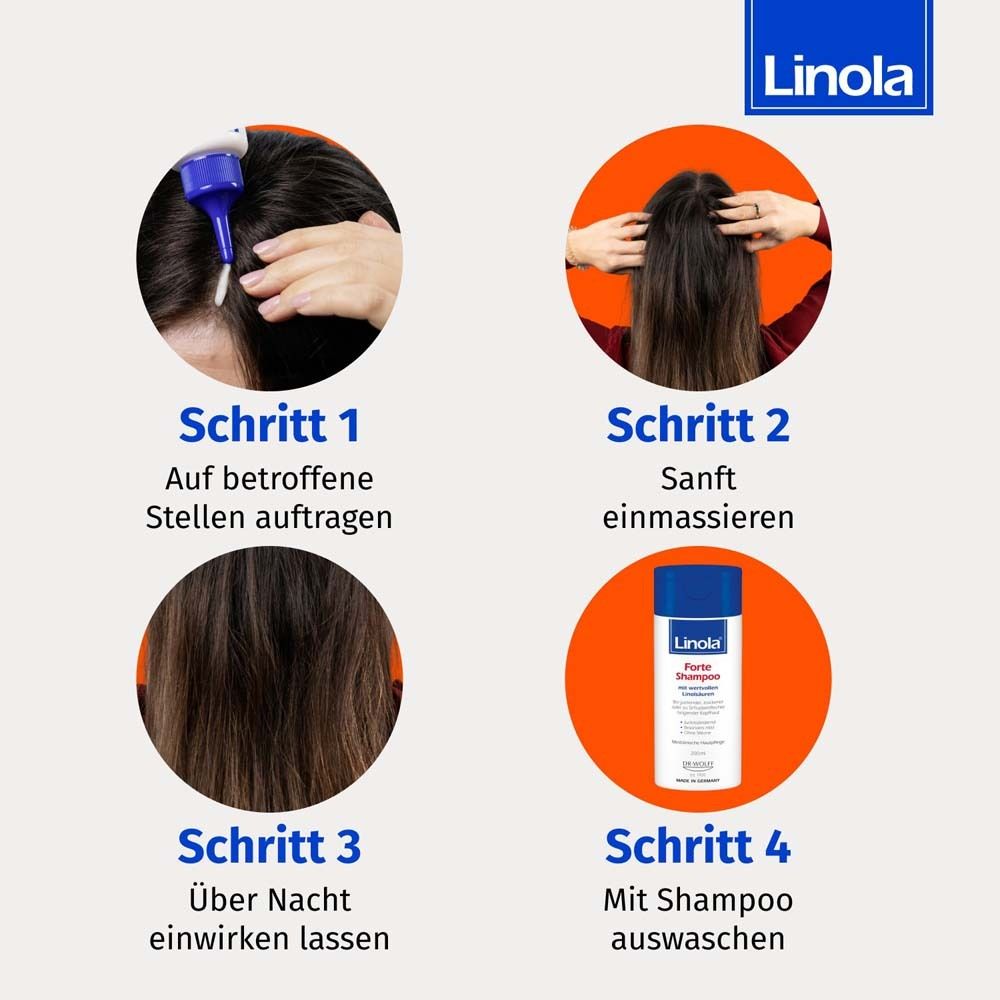 Vier stappen voor het aanbrengen van Linola Forte Hoofdhuid-Tonikum en shampoo.