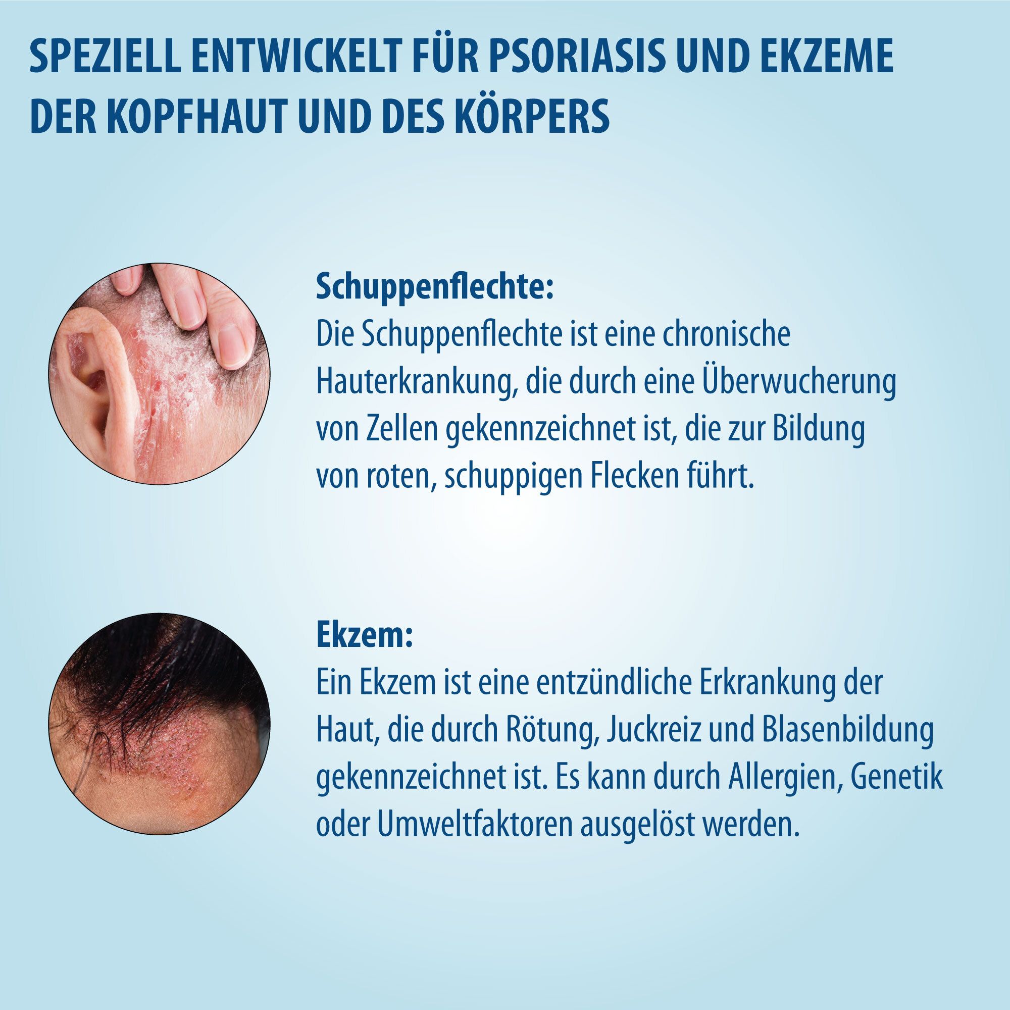 Tekst over psoriasis en eczeem. Afbeeldingen van huiduitslag. Tekst: Speciaal ontwikkeld voor psoriasis en eczeem.