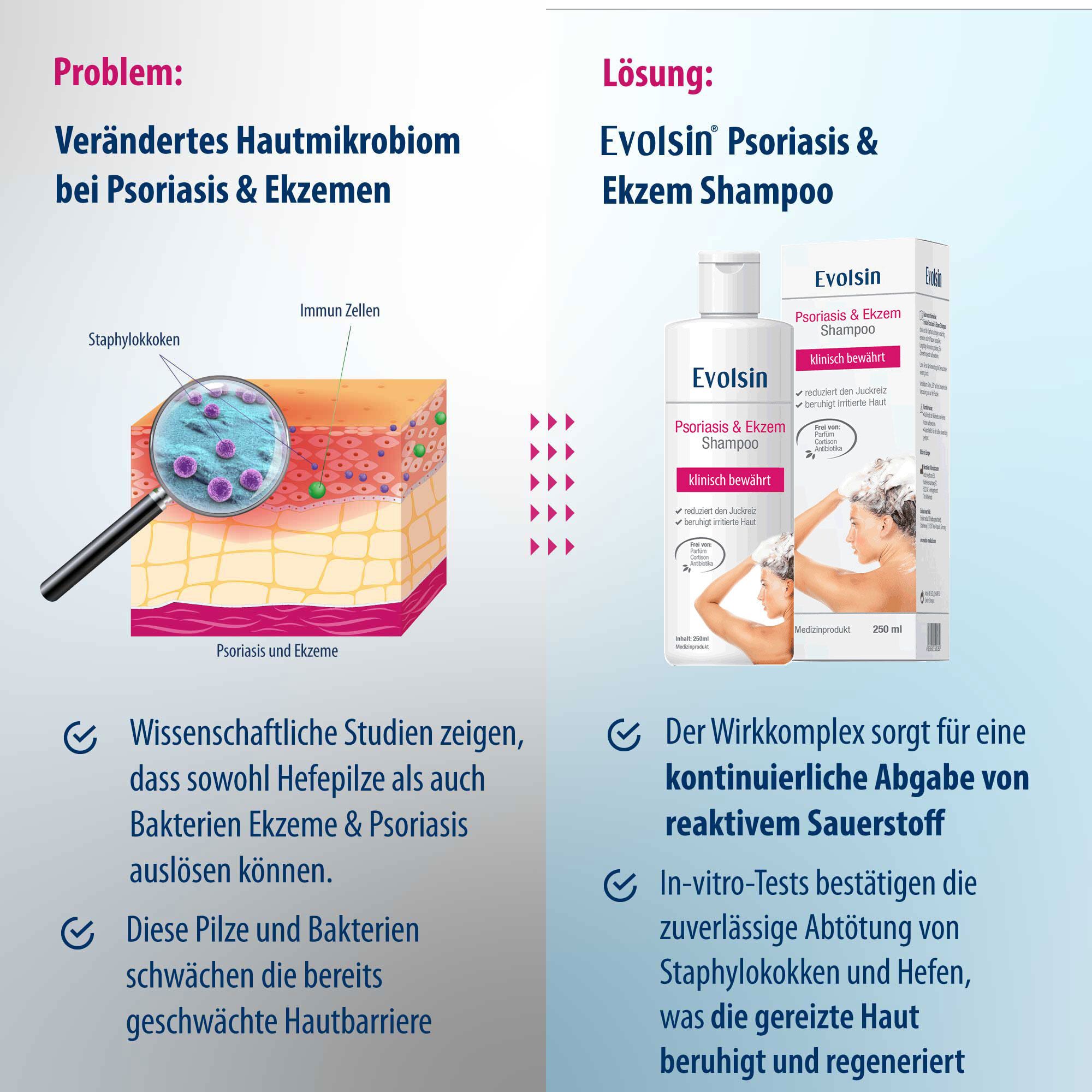 Vergelijking van huidproblemen en oplossing. Shampoo fles. Tekst: Wetenschappelijke studies tonen aan... Werkzaam complex...