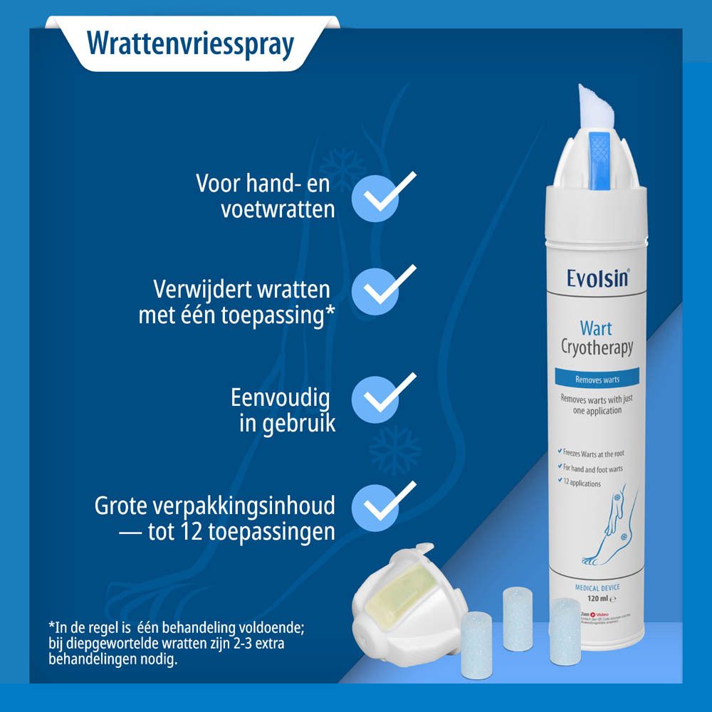 Illustratie van bevriezing van een wrat tot de wortel. Huidmodel met wrat.