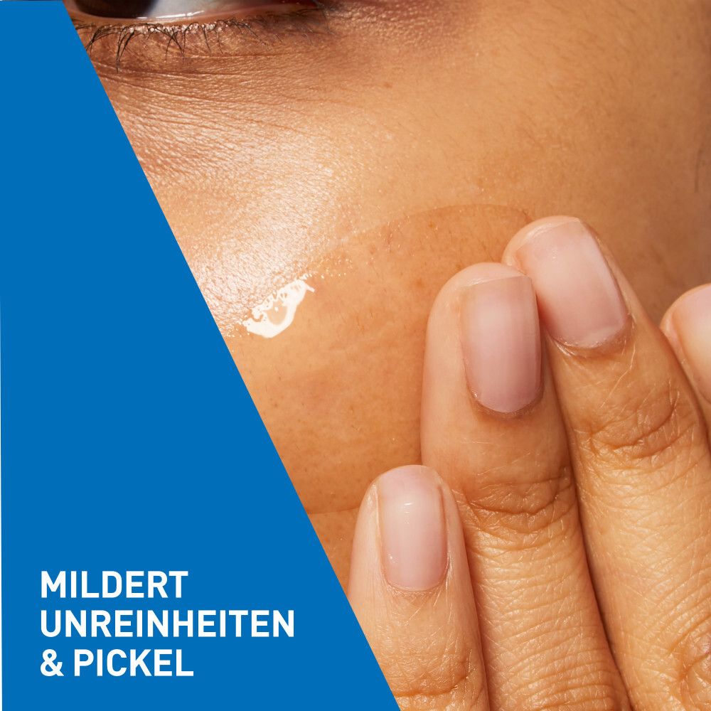 Gros plan sur une peau. Application de gel. Atténue les imperfections et les boutons.