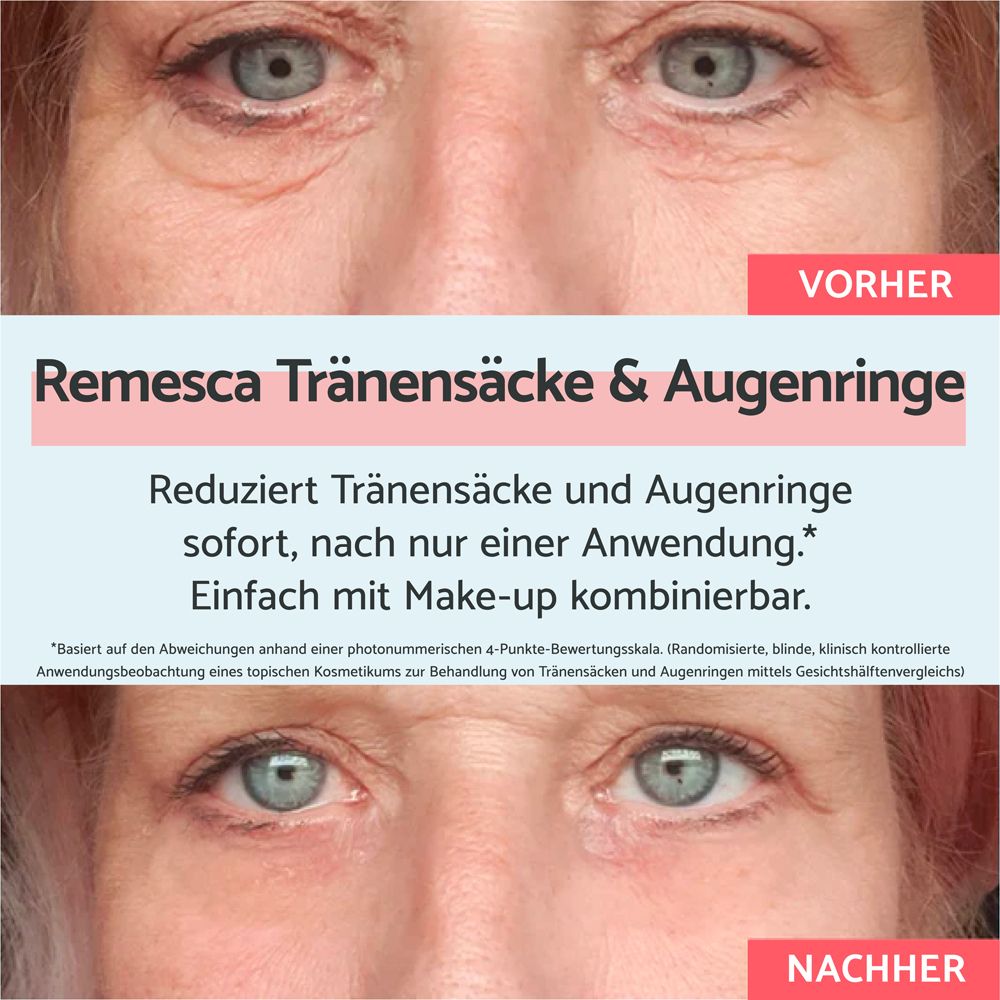 Emballage du produit. Inscription : Remescar Tränensäcke & Augenringe. Réduit les poches et cernes.