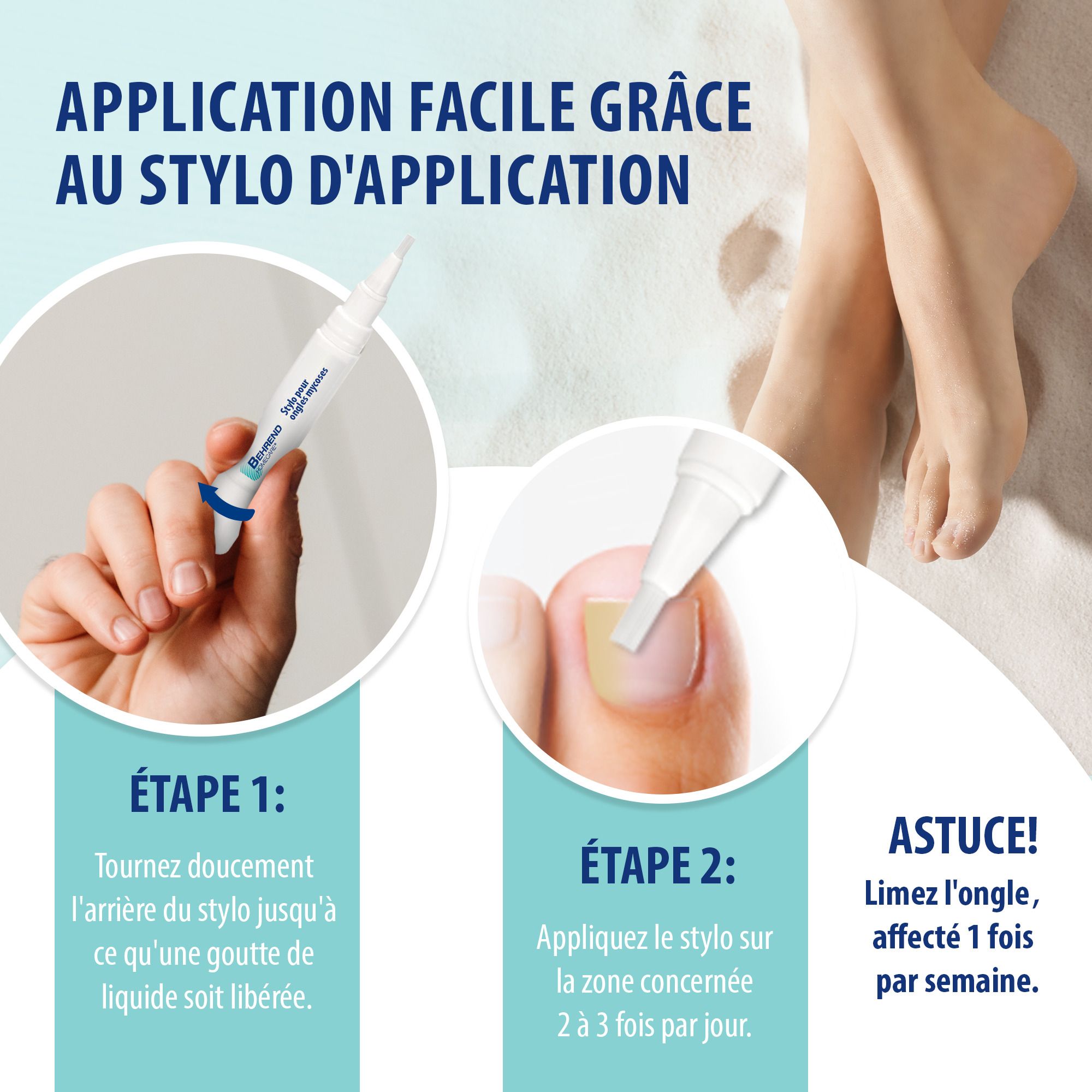 Infographie. Le traitement de la mycose des ongles prend du temps. Appliquer jusqu'à repousse saine.