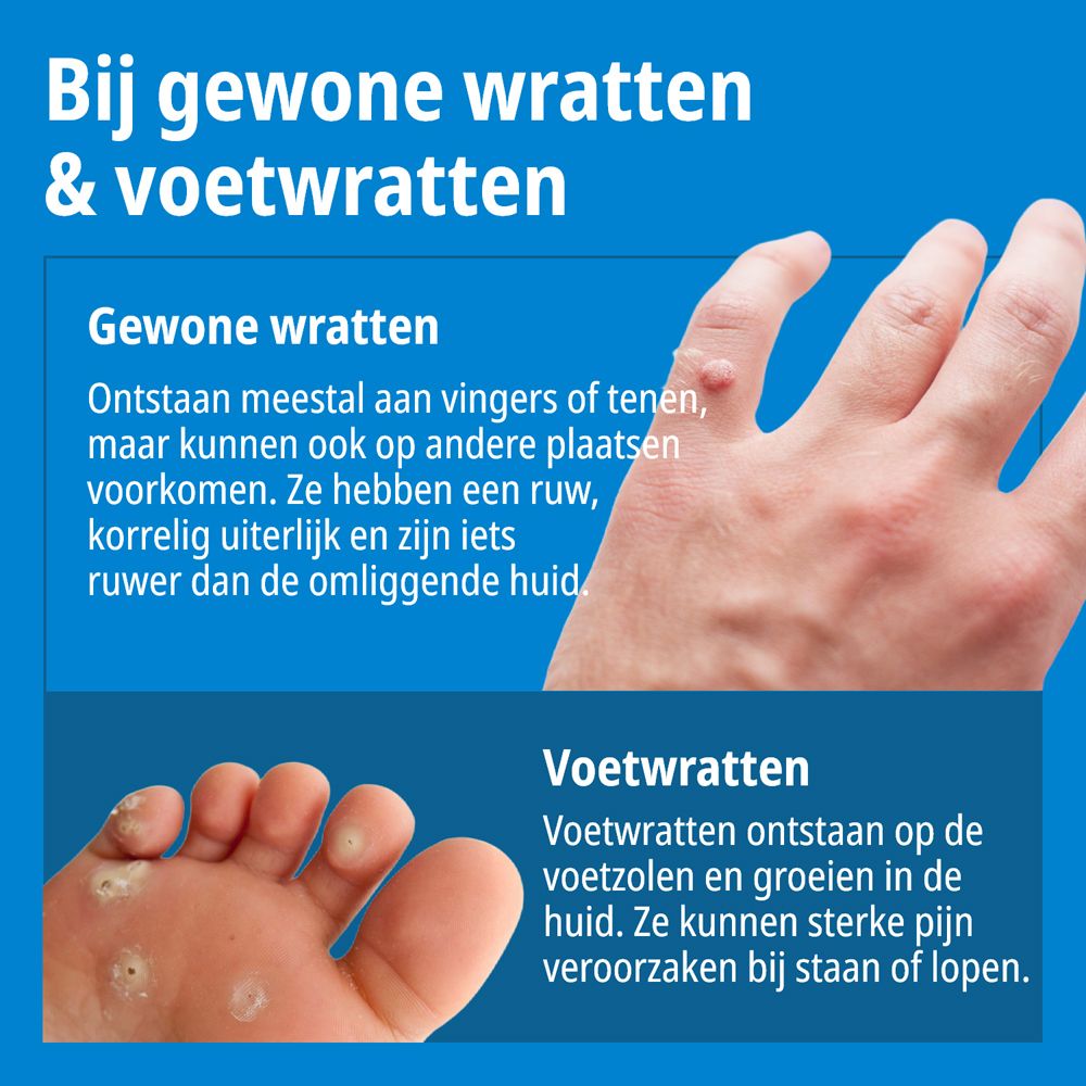 Zijaanzicht van de Evolsin Anti-wrattenstift verpakking met gebruiksinstructies en CE-markering.