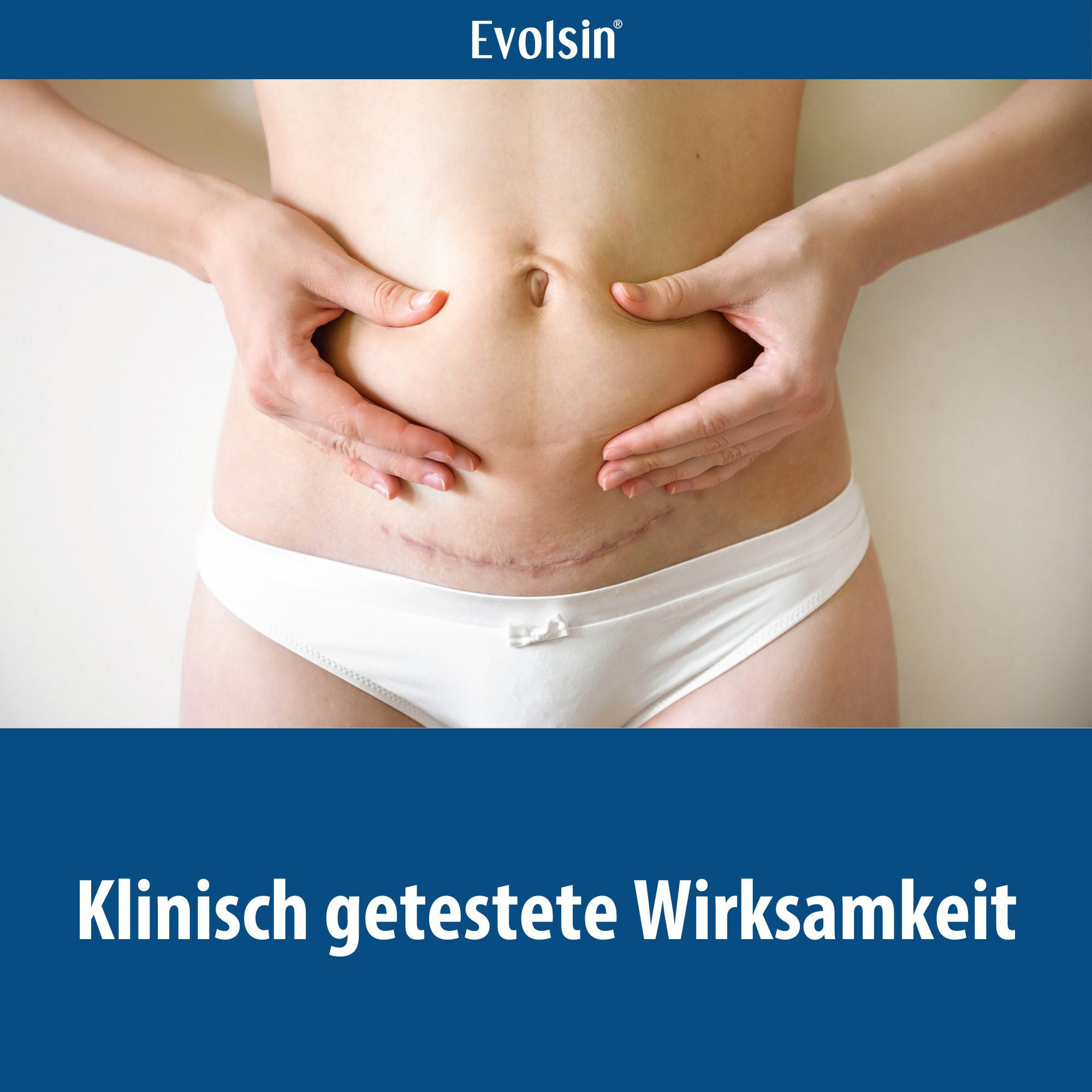 Buik van een vrouw met litteken. Tekst: Klinisch geteste effectiviteit.