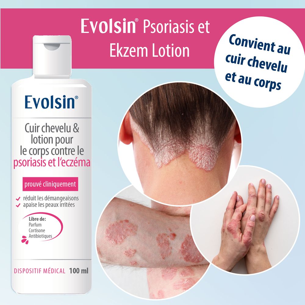 Bouteille de lotion Evolsin avec indications pour le traitement du psoriasis.