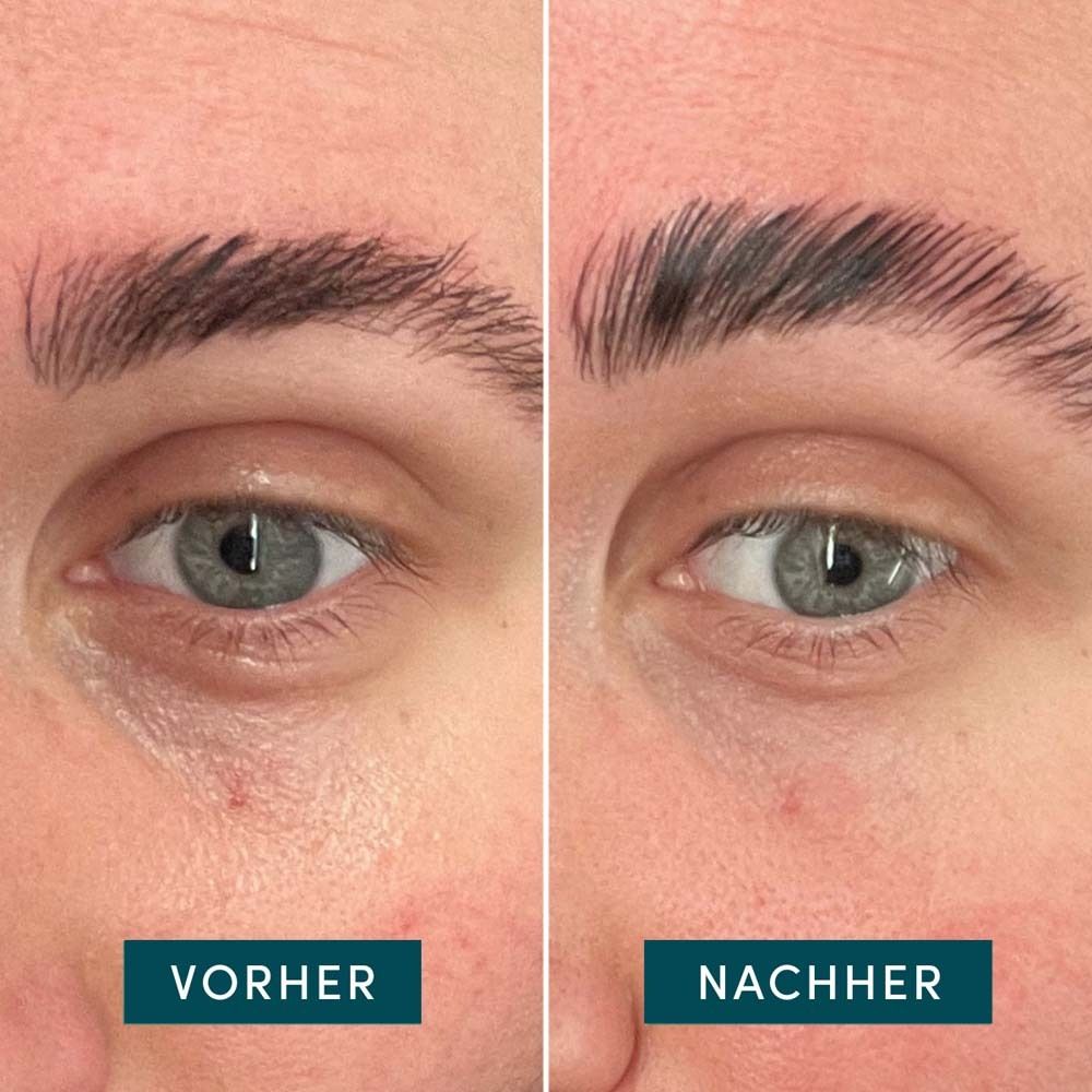 Comparaison : zone des yeux avant et après. Les sourcils sont plus fournis après utilisation.