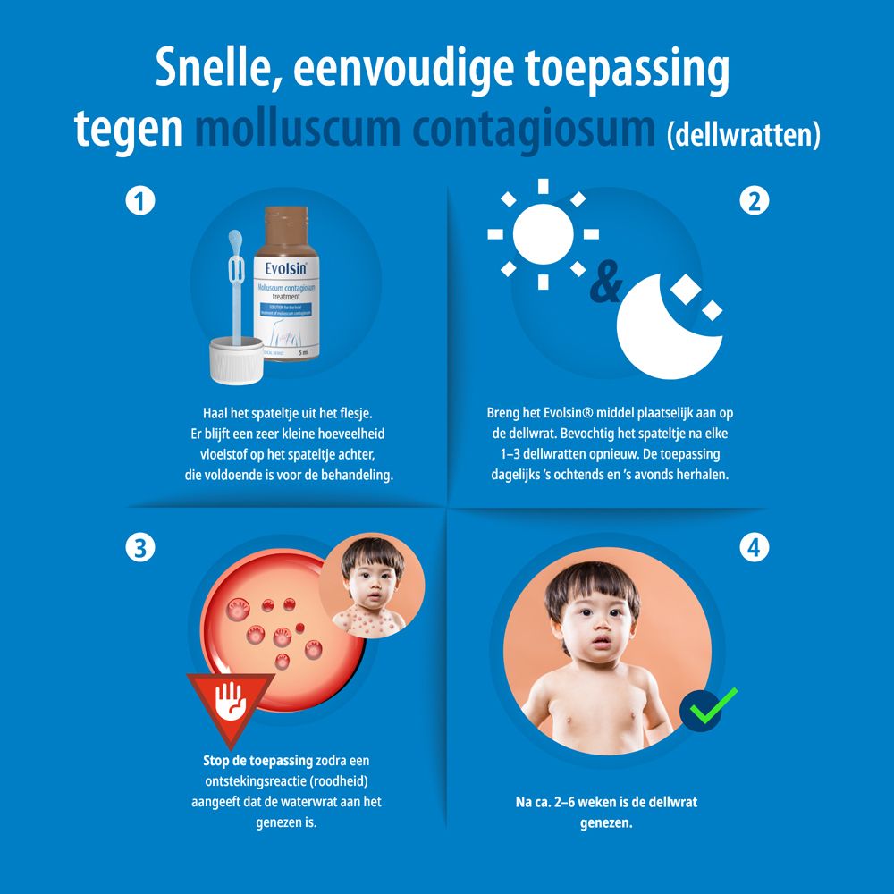Verpakking en fles Evolsin® Molluscum contagiosum treatment, illustratie van laesies.