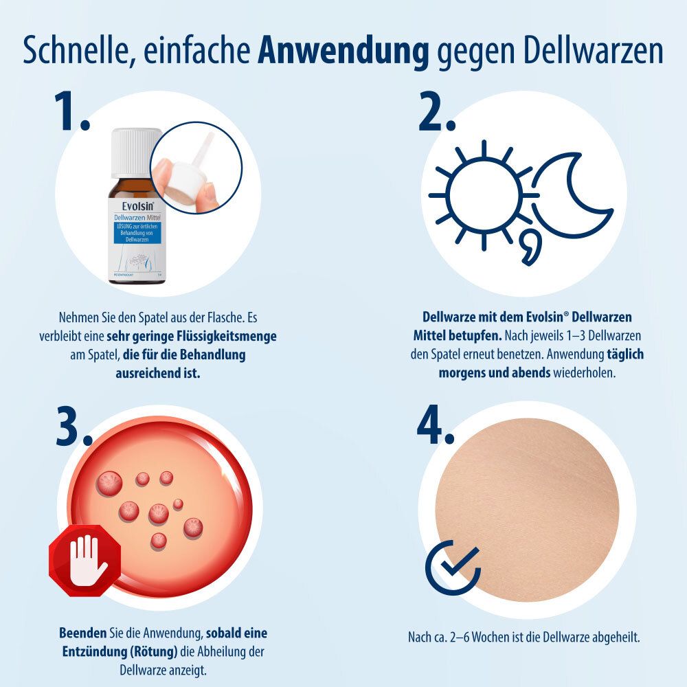 Grafiek. Toepassing tegen molluscum contagiosum. 1. Spatel. 2. 's Ochtends en 's avonds deppen. 3. Roodheid. 4. Genezen na 2-6 weken.
