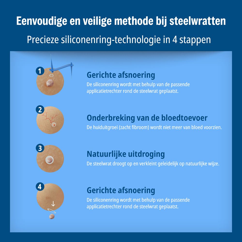 Toepassing Evolsin Anti Steelwratjes: 4 stappen voor het verwijderen van steelwratjes.