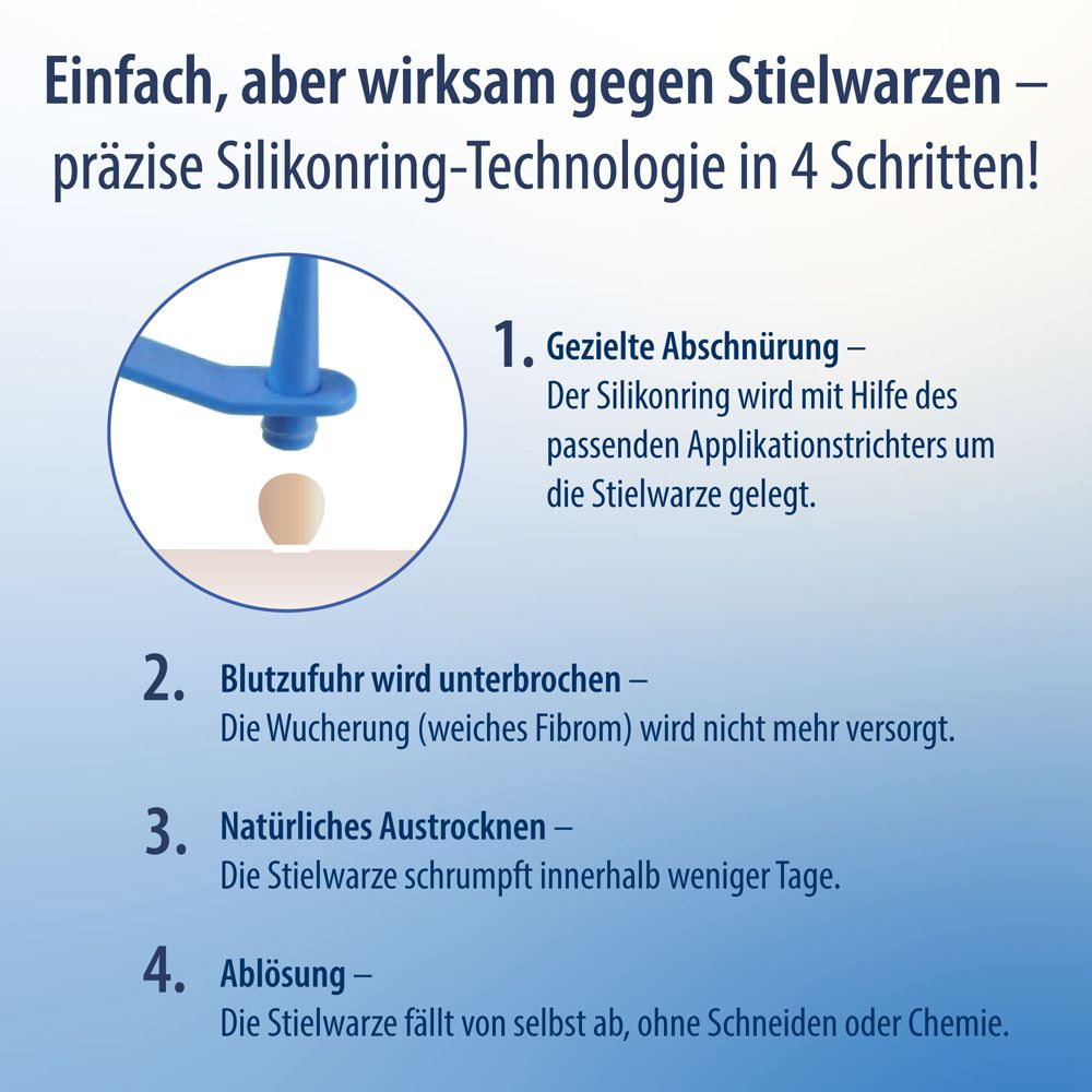 Infographic: Gebruik van Evolsin Anti Stielwarze in 4 stappen. Siliconen ring technologie.