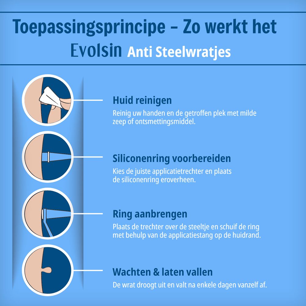 Toepassingsstappen Evolsin Anti Stielwarzen: huid reinigen, siliconenring voorbereiden, aanbrengen en wachten.