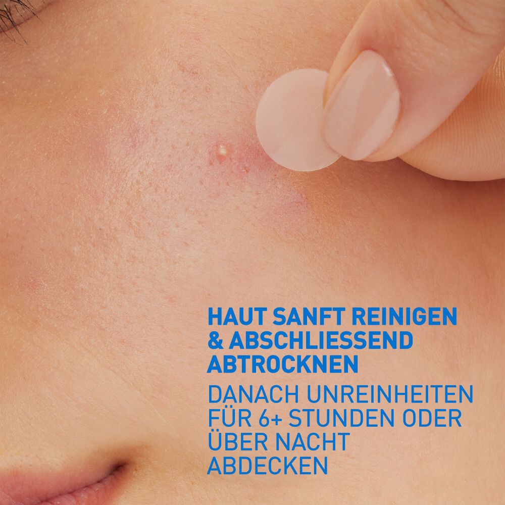CeraVe Reiniging en Anti-Onzuiverheden Patches. Fles en verpakking. Routine voor acne-gevoelige huid.