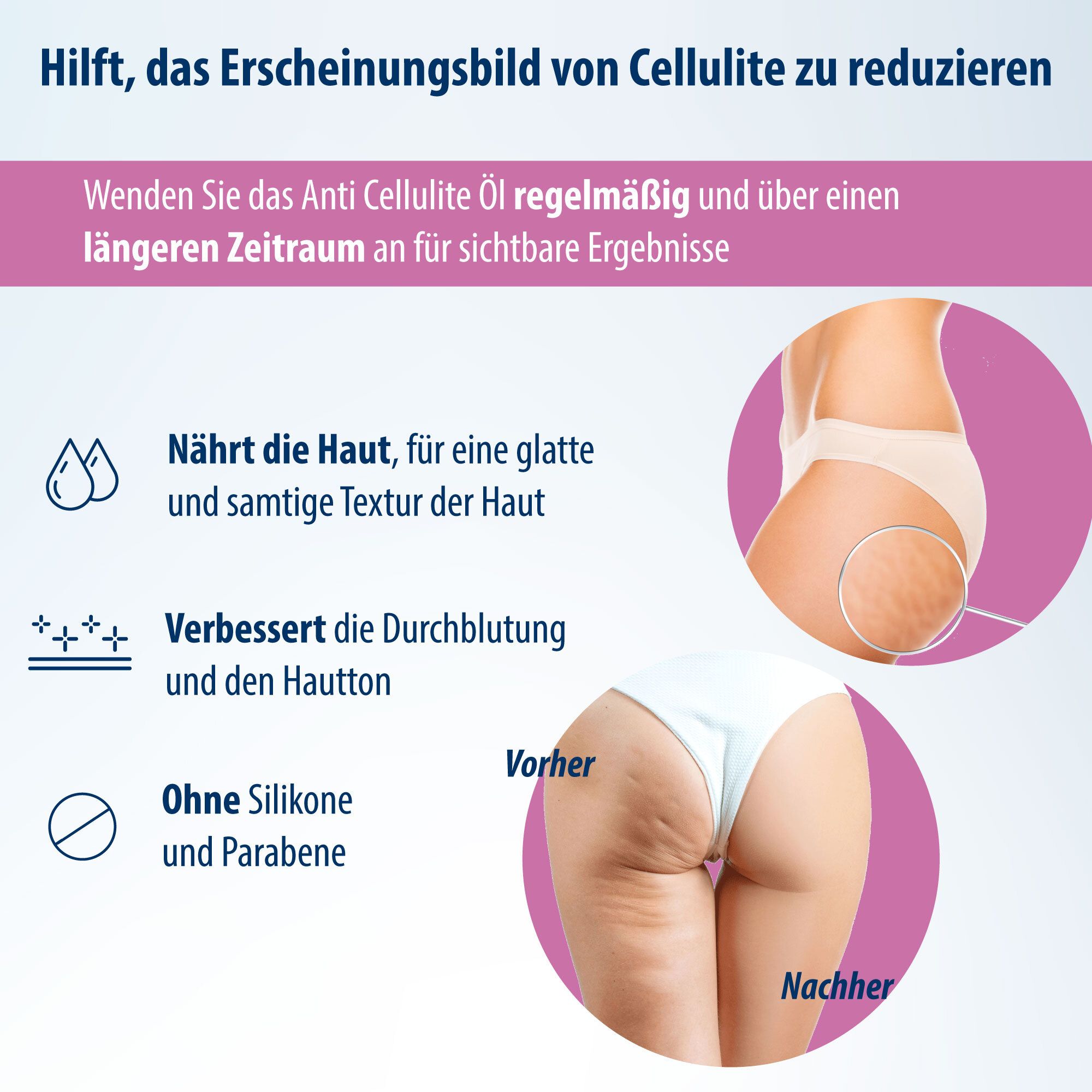 Infographic over anti-cellulitisolie. Toont voor- en na-effect. Voedt de huid, verbetert de bloedsomloop, zonder siliconen en parabenen.