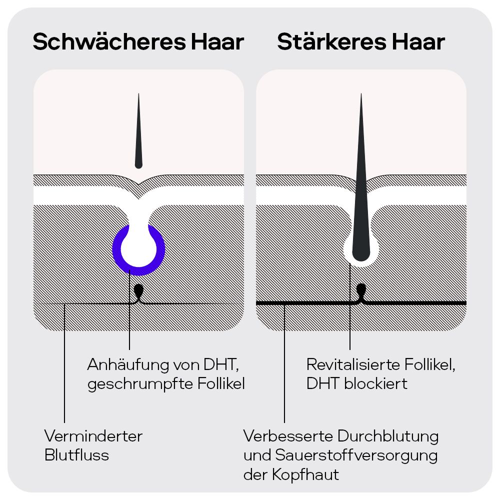 Graphique: cheveux avec et sans blocage DHT. Texte: Cheveux plus faibles/plus forts.