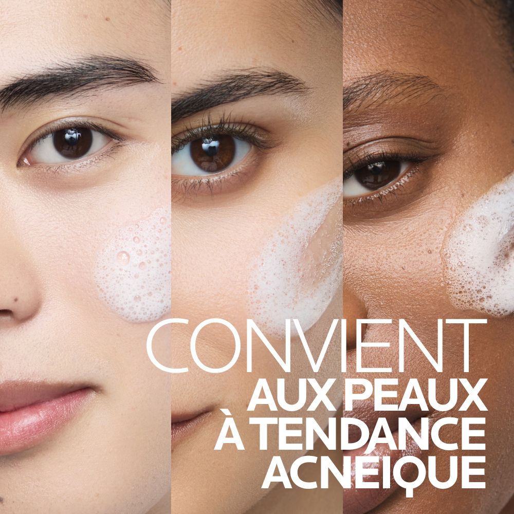 Collage van gezichten van verschillende etniciteiten met schuim, tekst: "Geschikt voor acne-gevoelige huid".