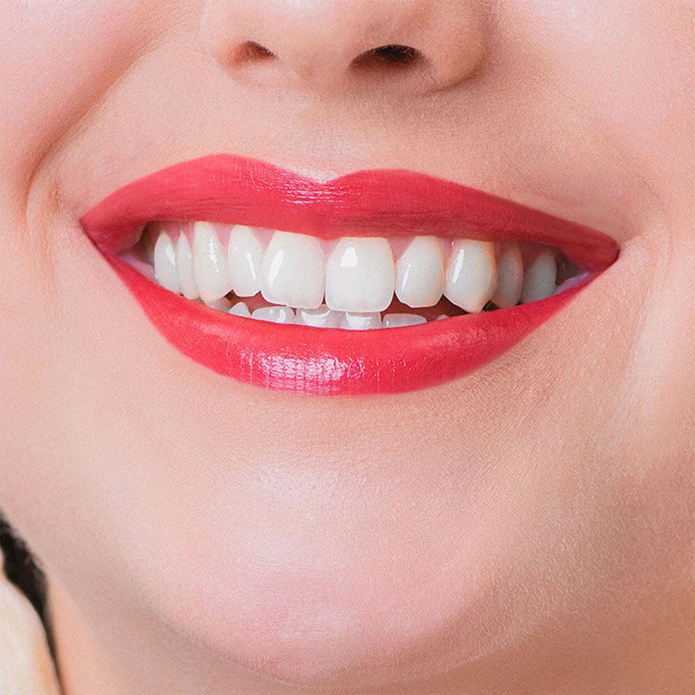 Gros plan d'un sourire avec des lèvres rouges. Dents clairement visibles.