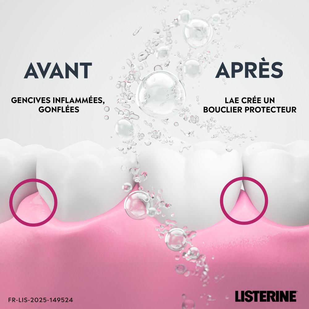 Dents et gencives. Avant : enflammé. Après : bouclier protecteur. Logo Listerine.