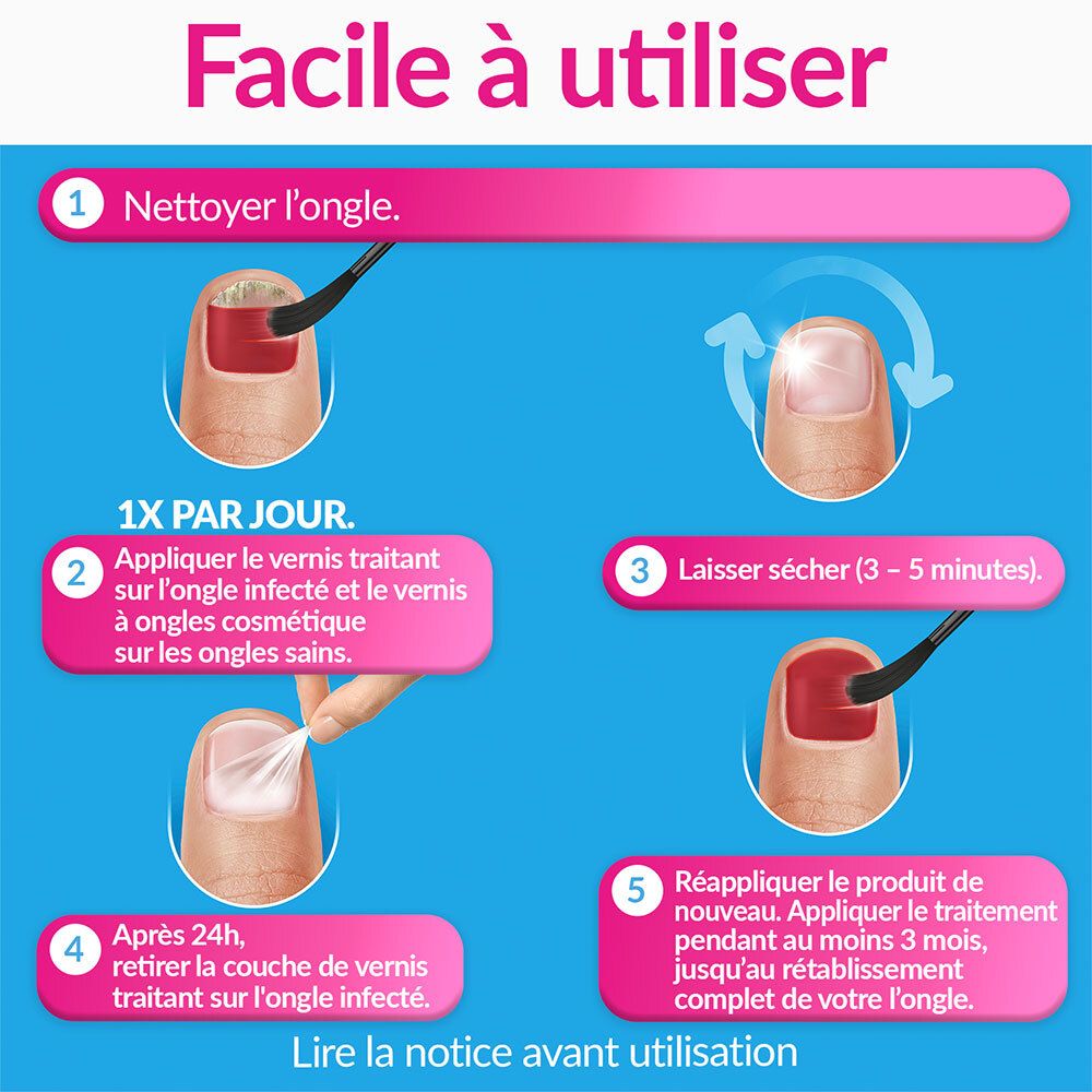 Étapes d'application eXcilor Forte Color : Nettoyer, appliquer, sécher, répéter.
