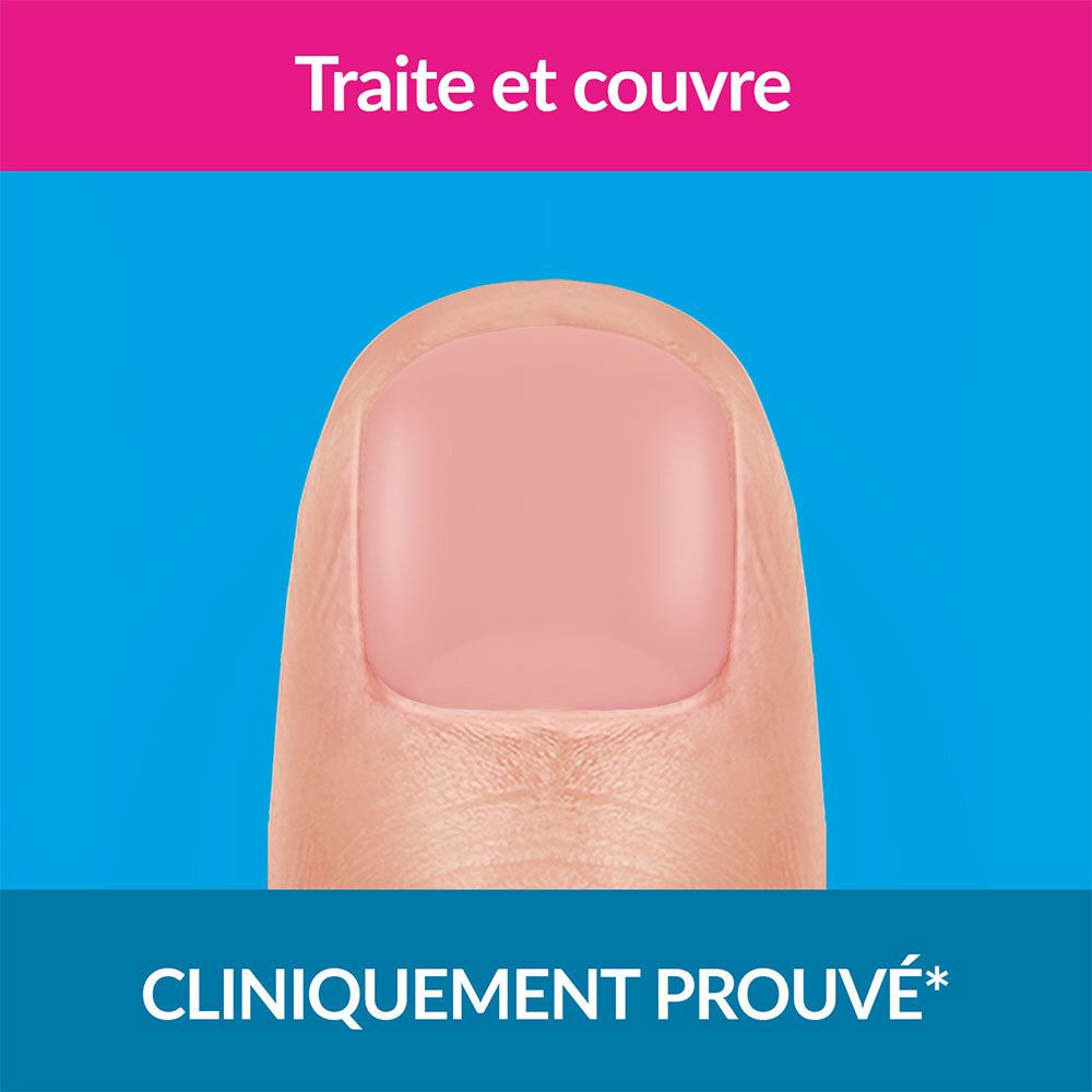 eXcilor Forte : Cliniquement prouvé pour le traitement de la mycose des ongles.